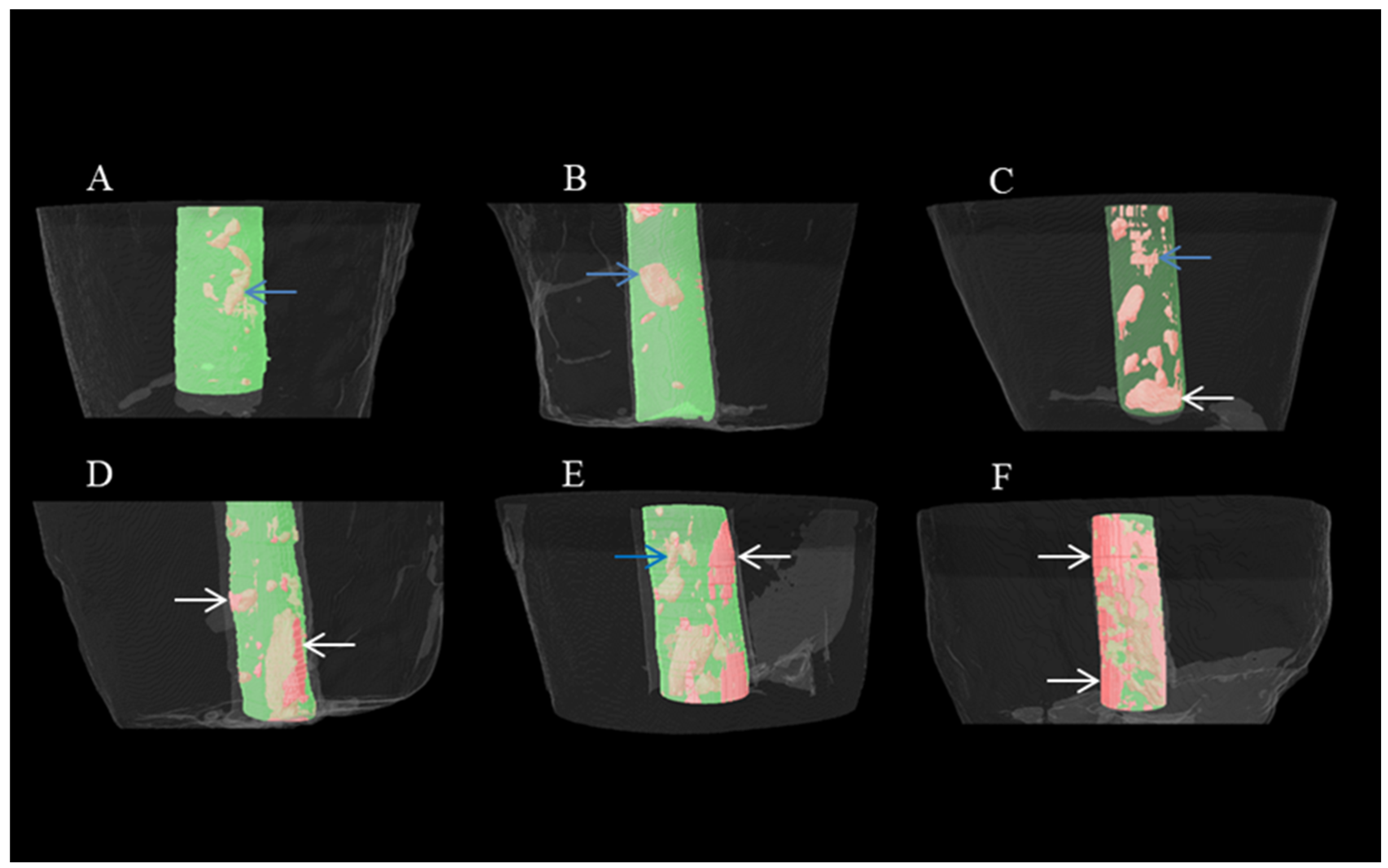 Medicina 60 00878 g004