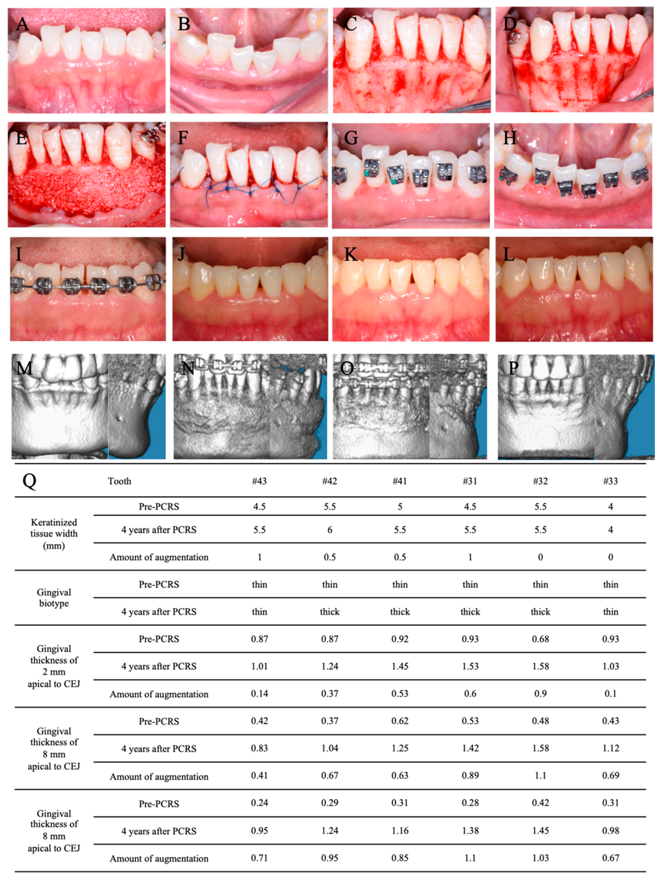 Medicina 60 00904 g005
