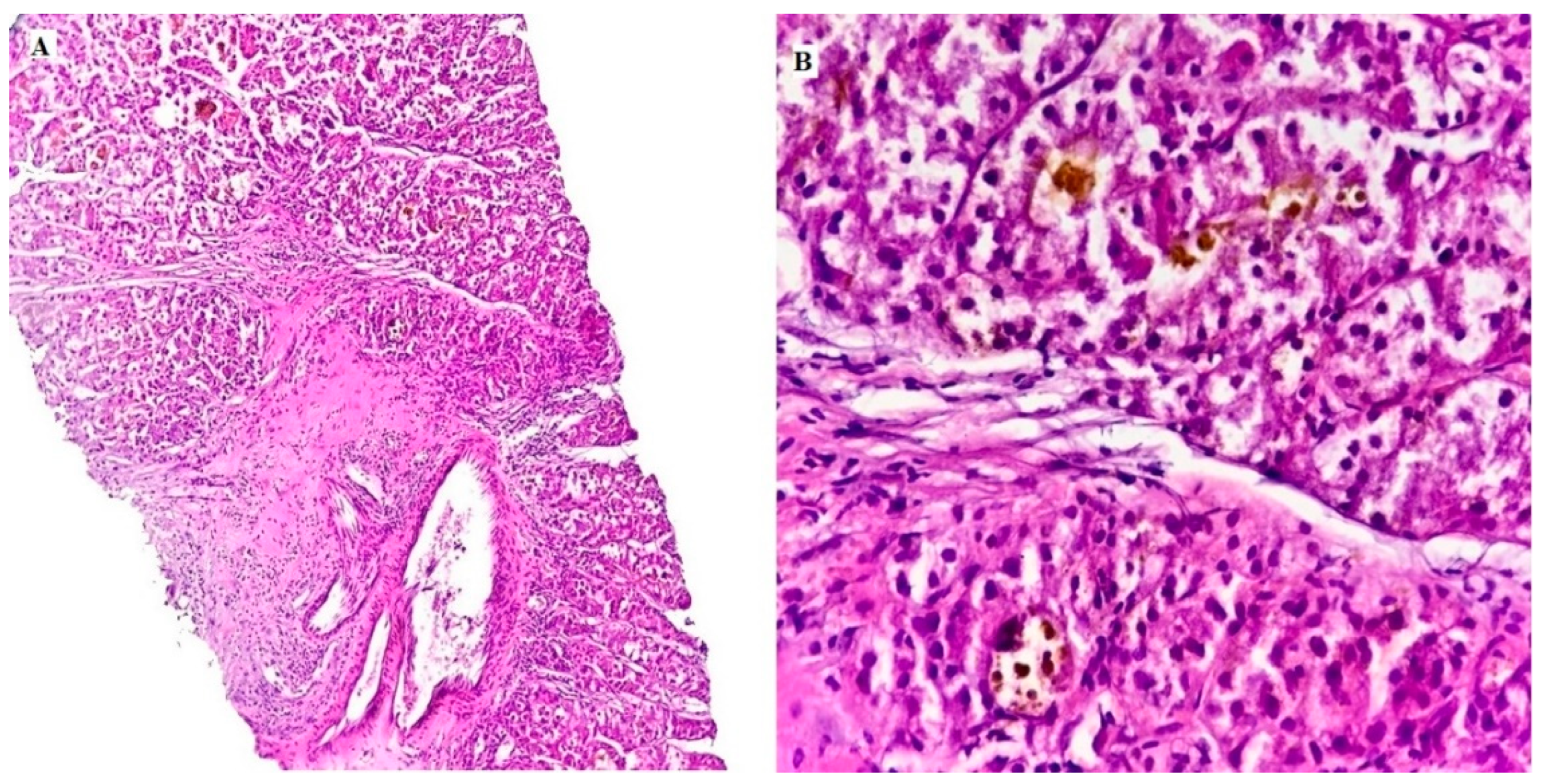 Medicina 60 00915 g001 Medicina 60 00915 g001