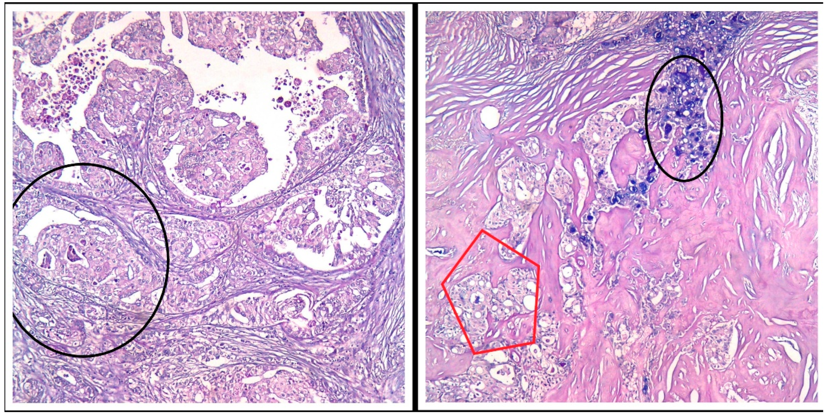 Medicina 60 00924 g003