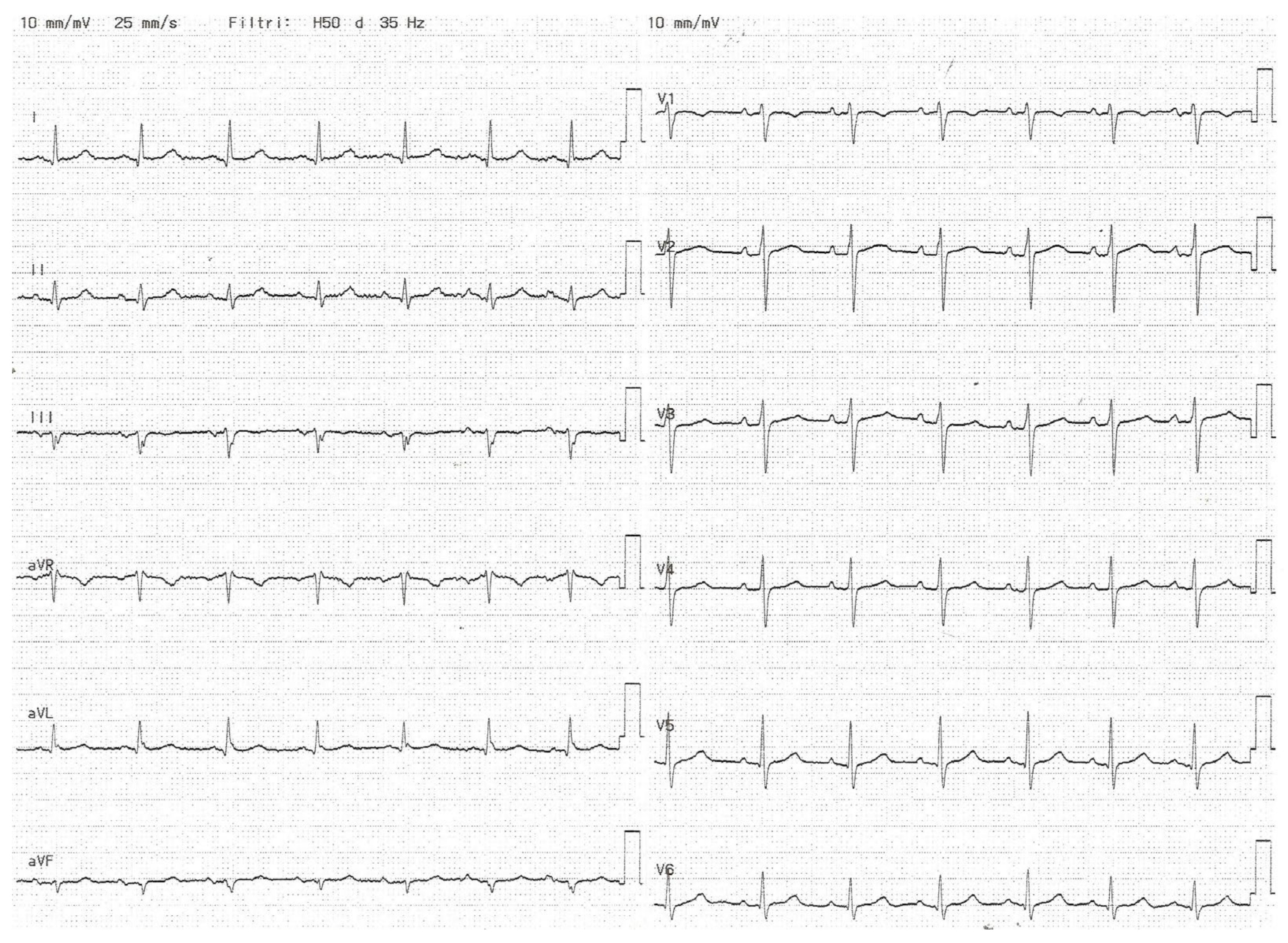 Medicina 60 01001 g004