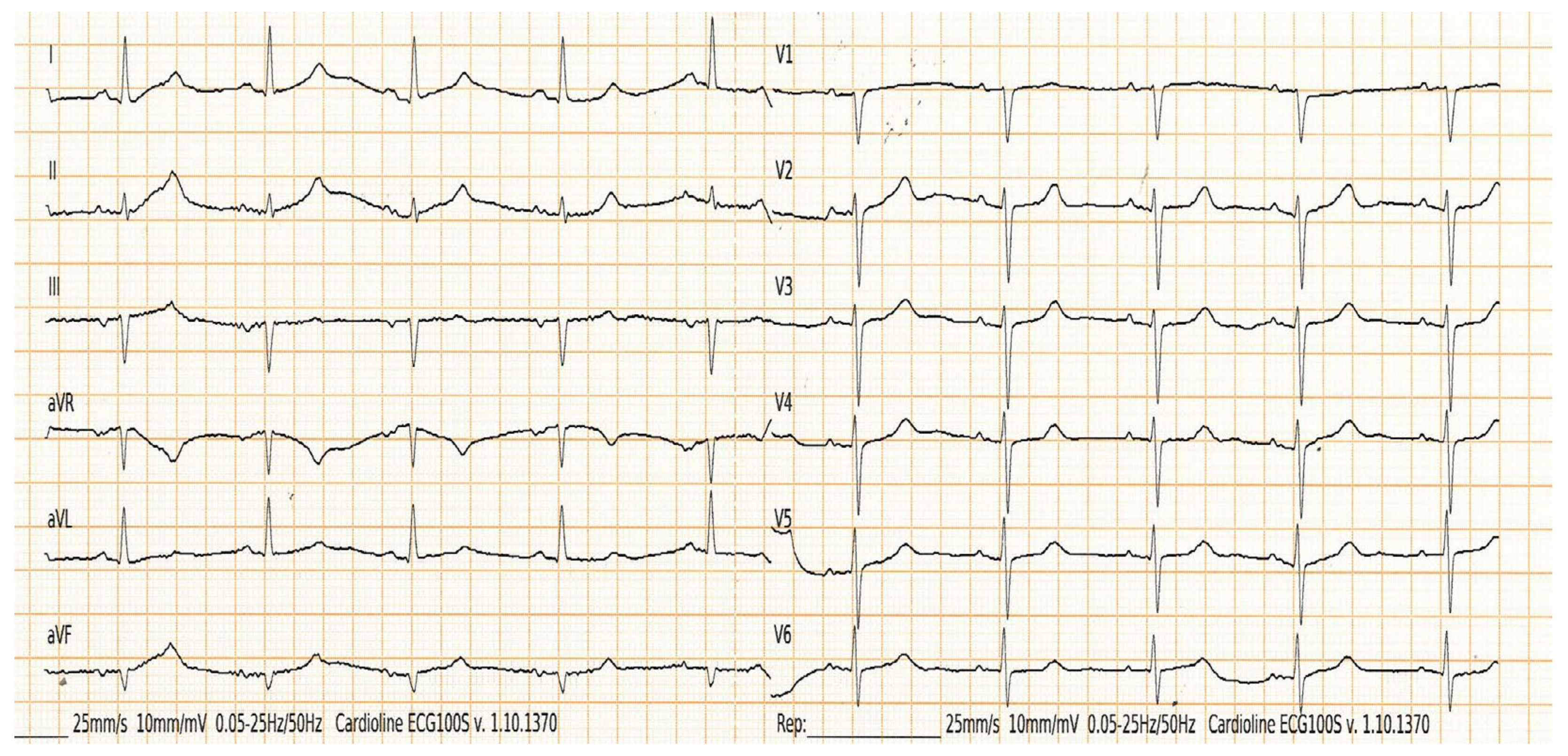 Medicina 60 01001 g005