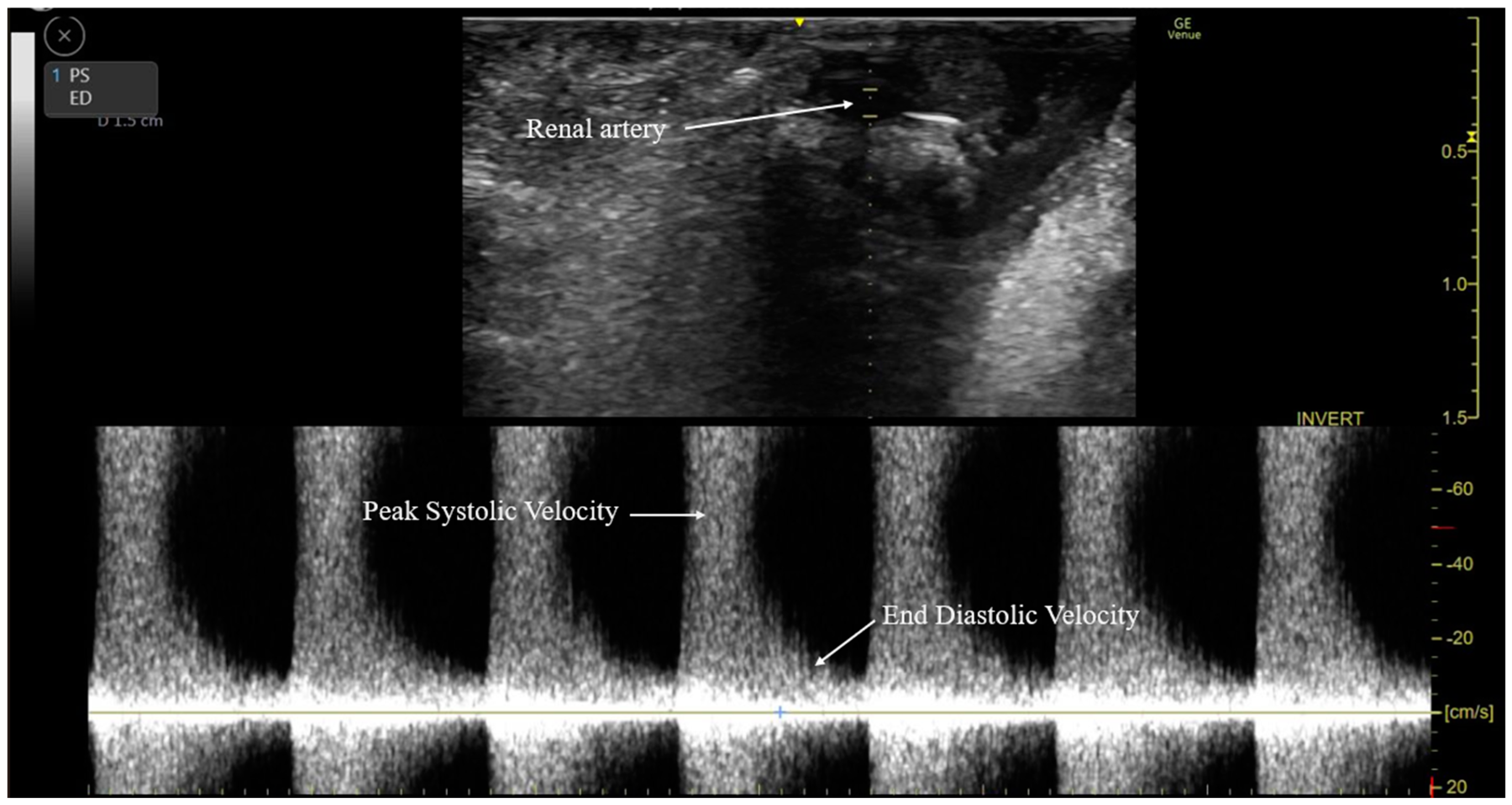Medicina 60 01066 g003