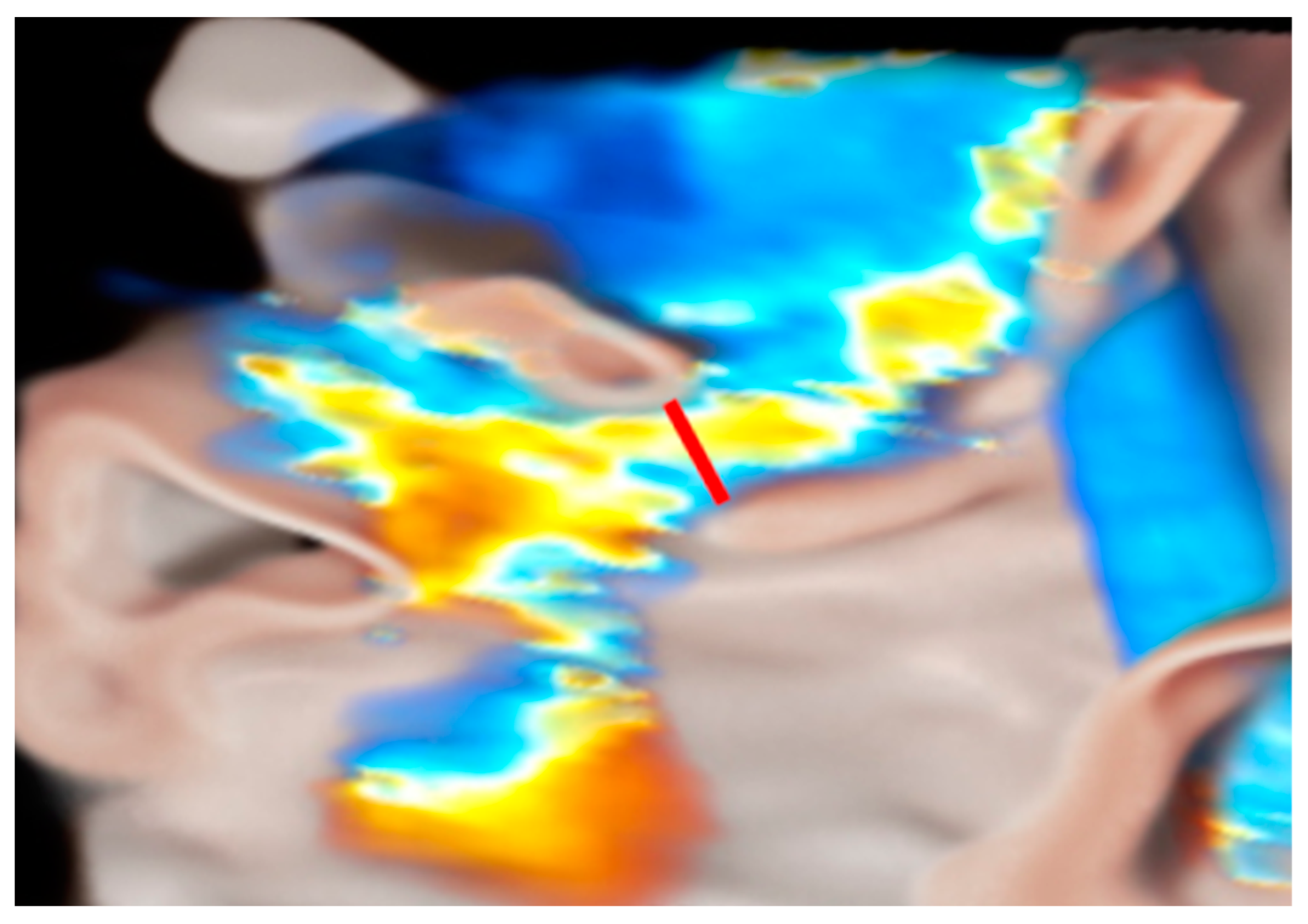 Medicina 60 01082 g005 Medicina 60 01082 g005