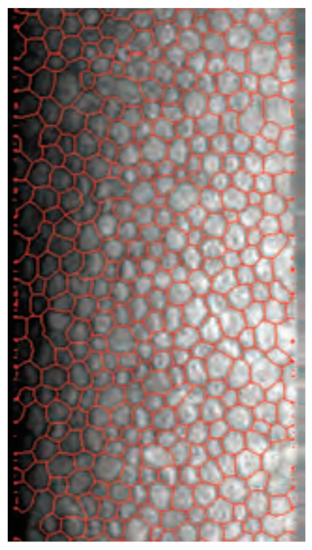 Medicina 60 01110 g005