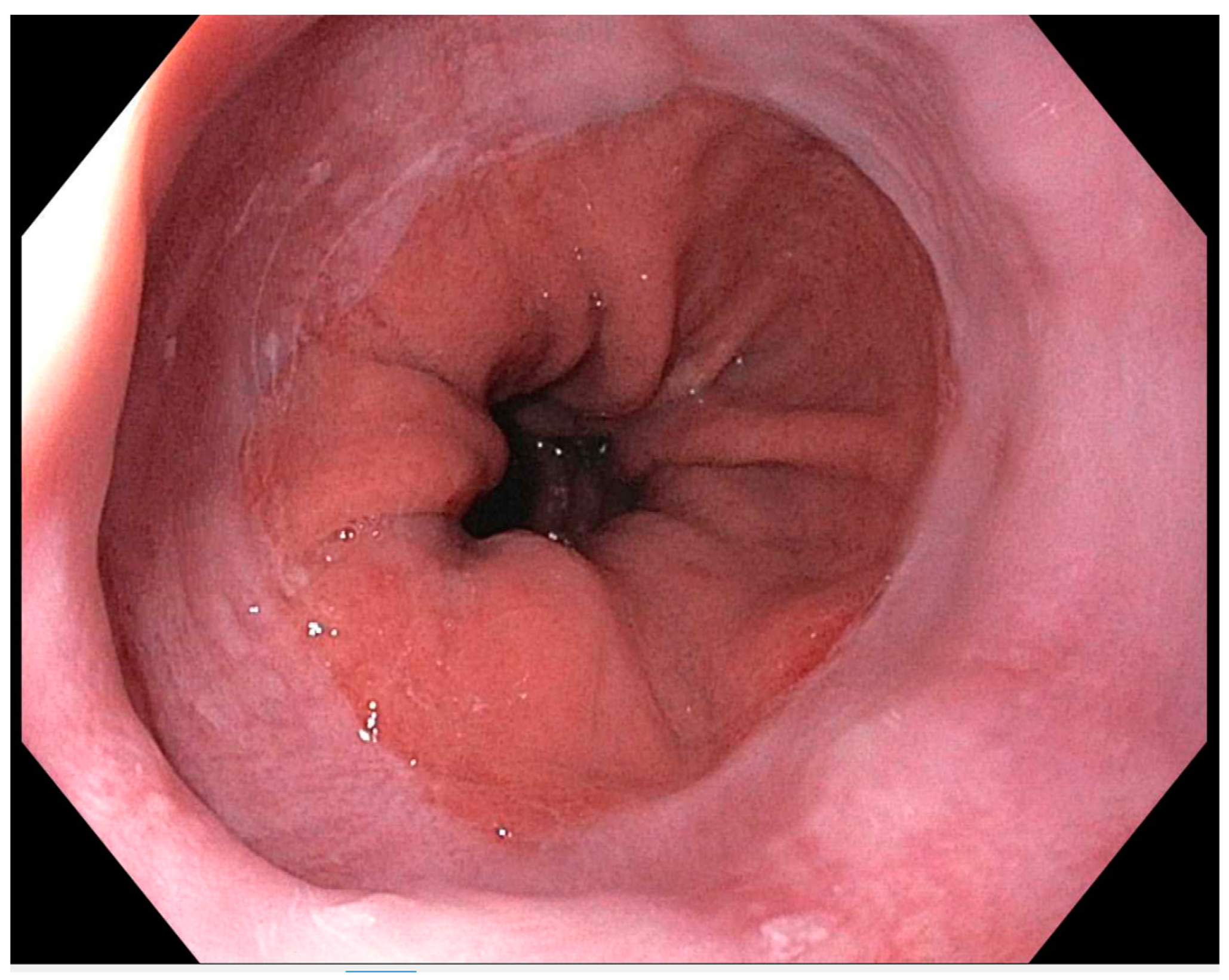 Medicina 60 01120 g002 Medicina 60 01120 g002
