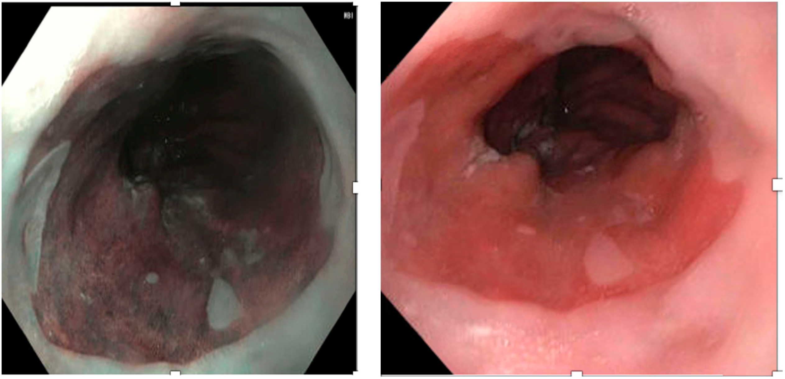 Medicina 60 01120 g003 Medicina 60 01120 g003