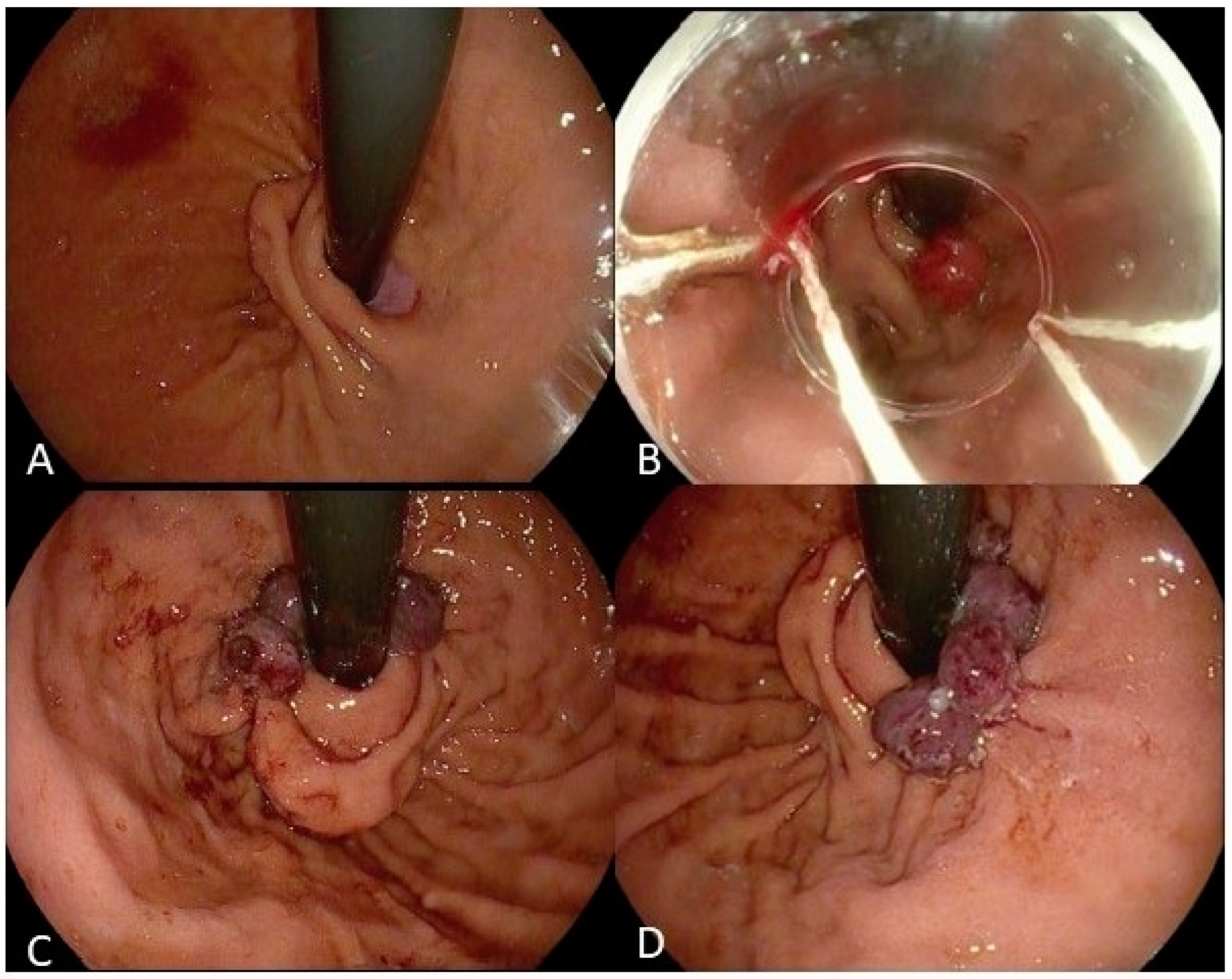 Medicina 60 01120 g006 Medicina 60 01120 g006