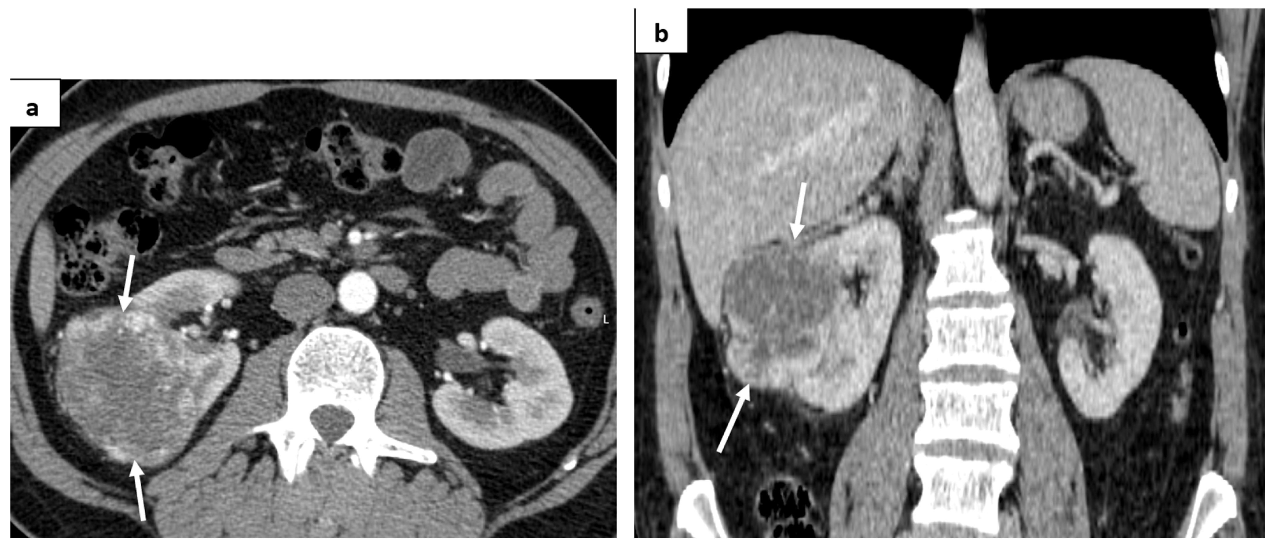 Medicina 60 01129 g001