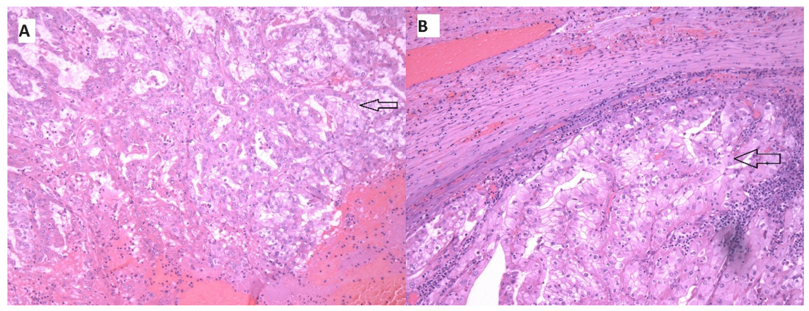 Medicina 60 01129 g002