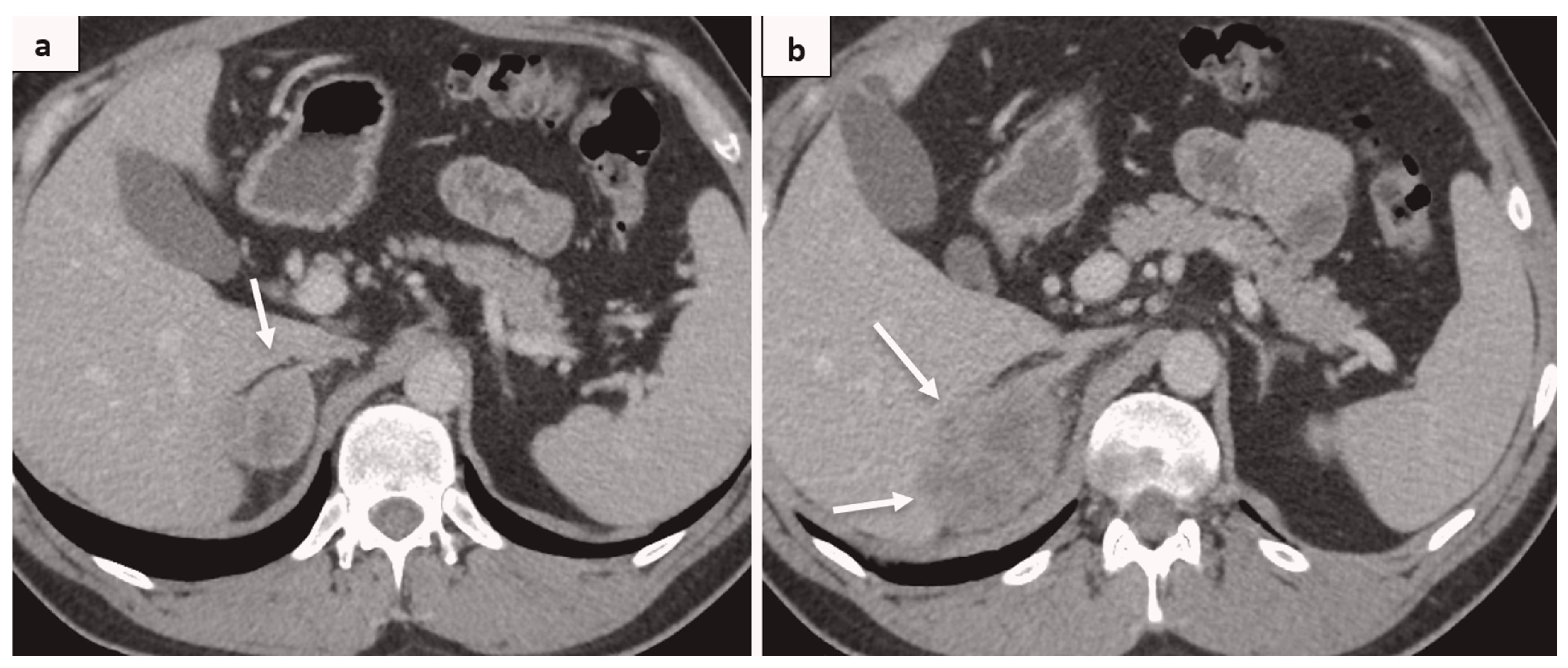 Medicina 60 01129 g003