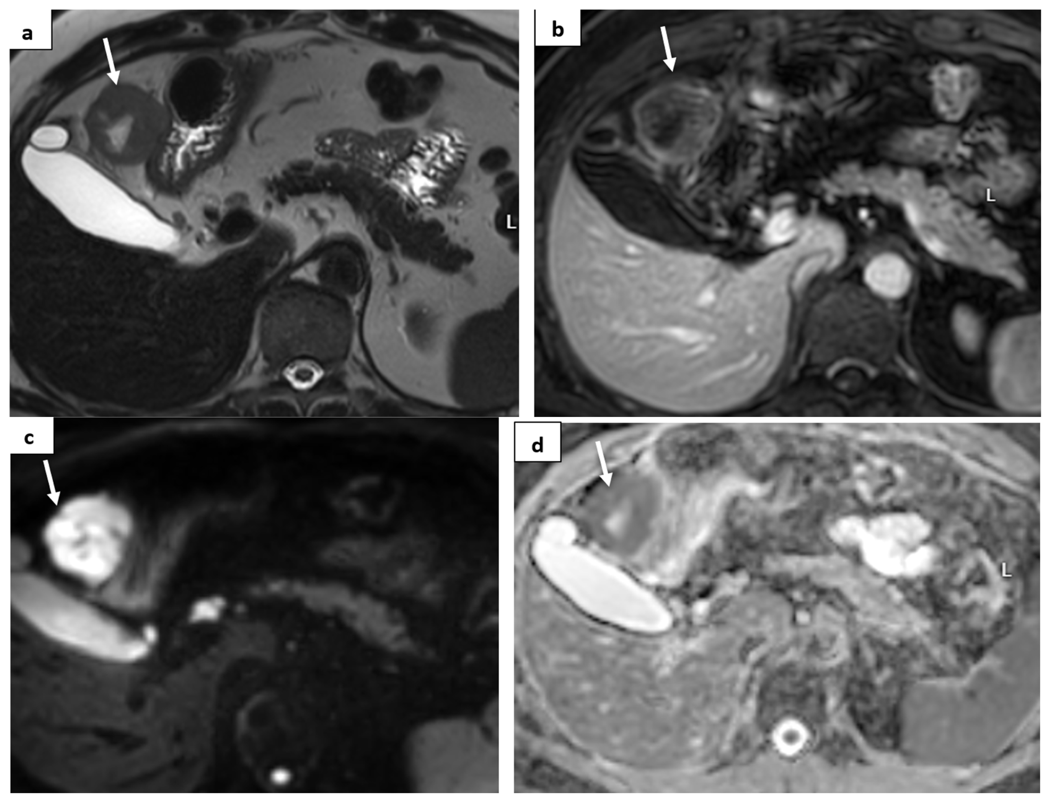 Medicina 60 01129 g004