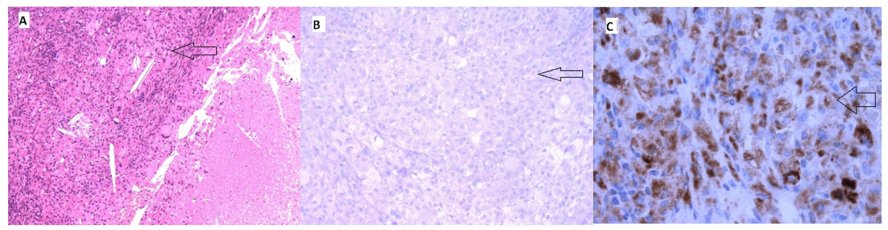 Medicina 60 01129 g006