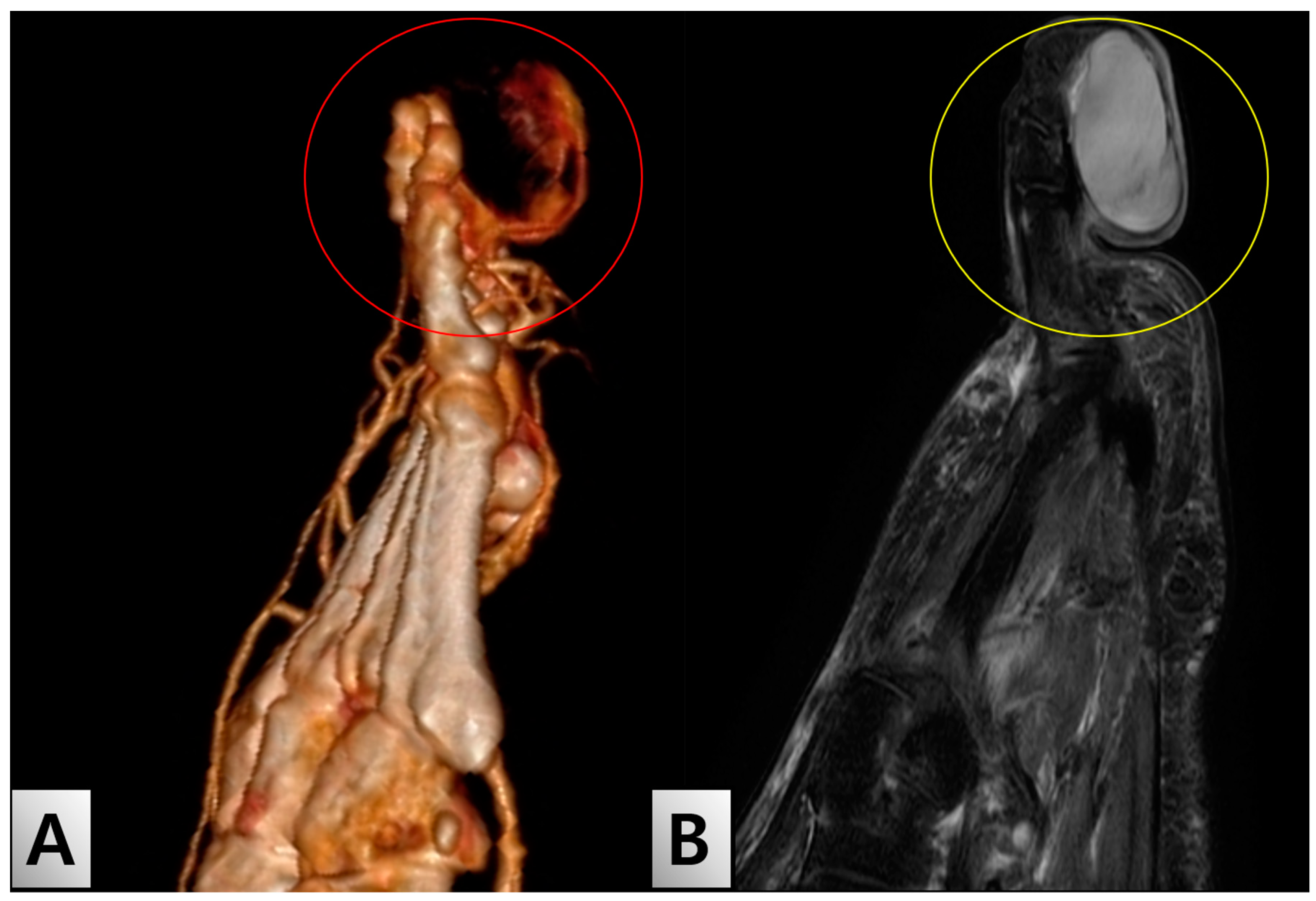 Medicina 60 01200 g002 Medicina 60 01200 g002