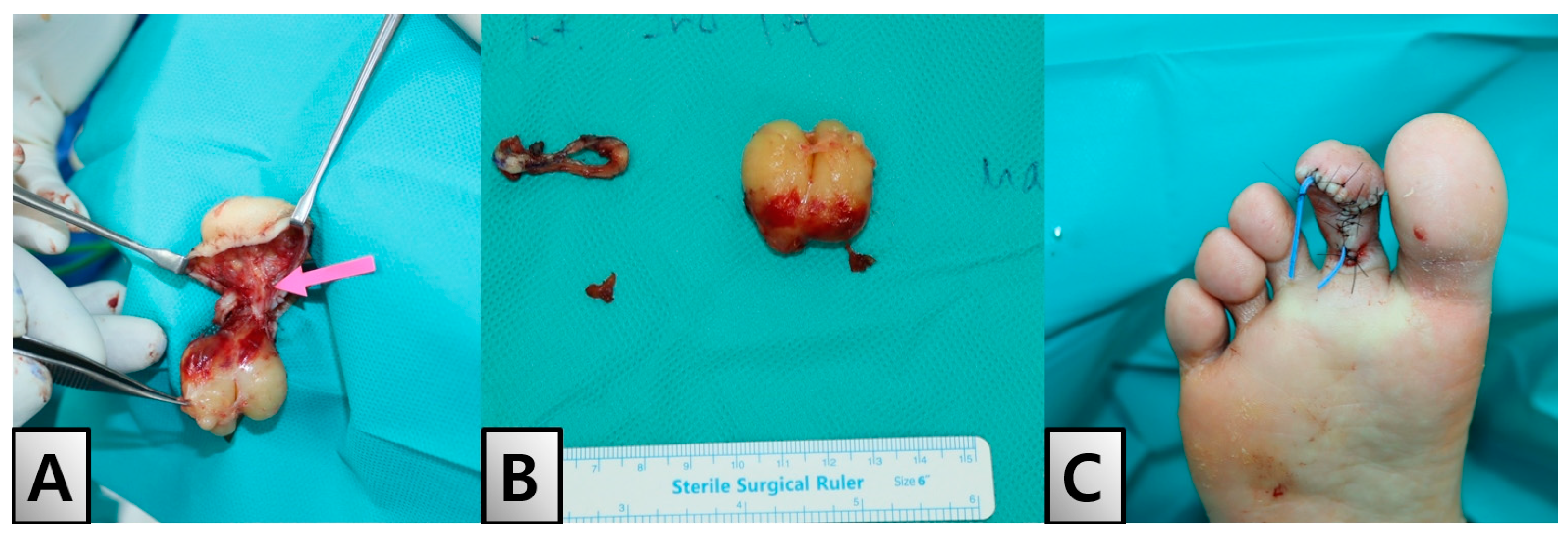 Medicina 60 01200 g004 Medicina 60 01200 g004