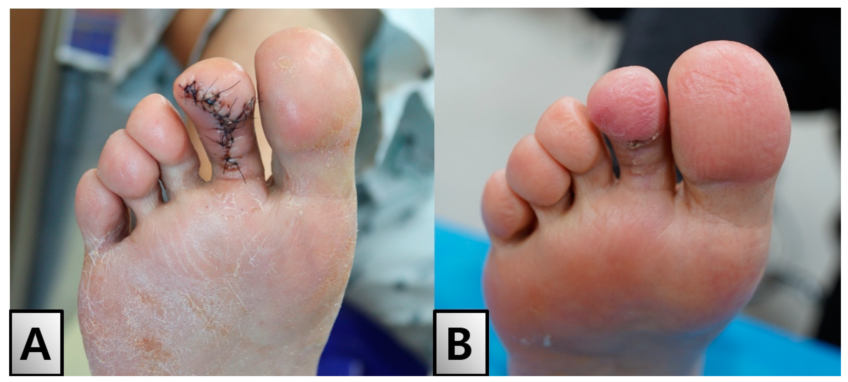 Medicina 60 01200 g005 Medicina 60 01200 g005