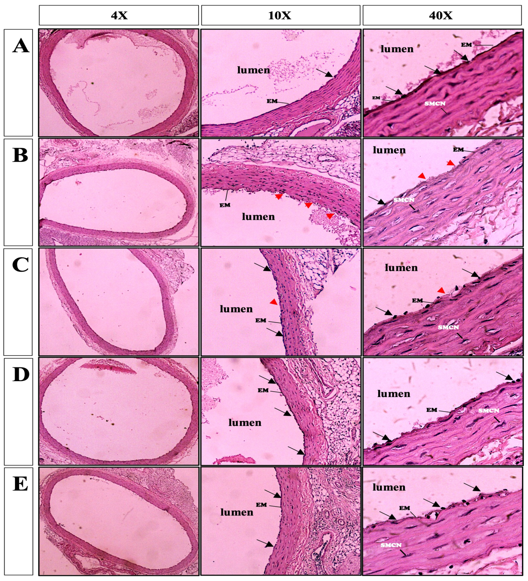 Medicina 60 01284 g005
