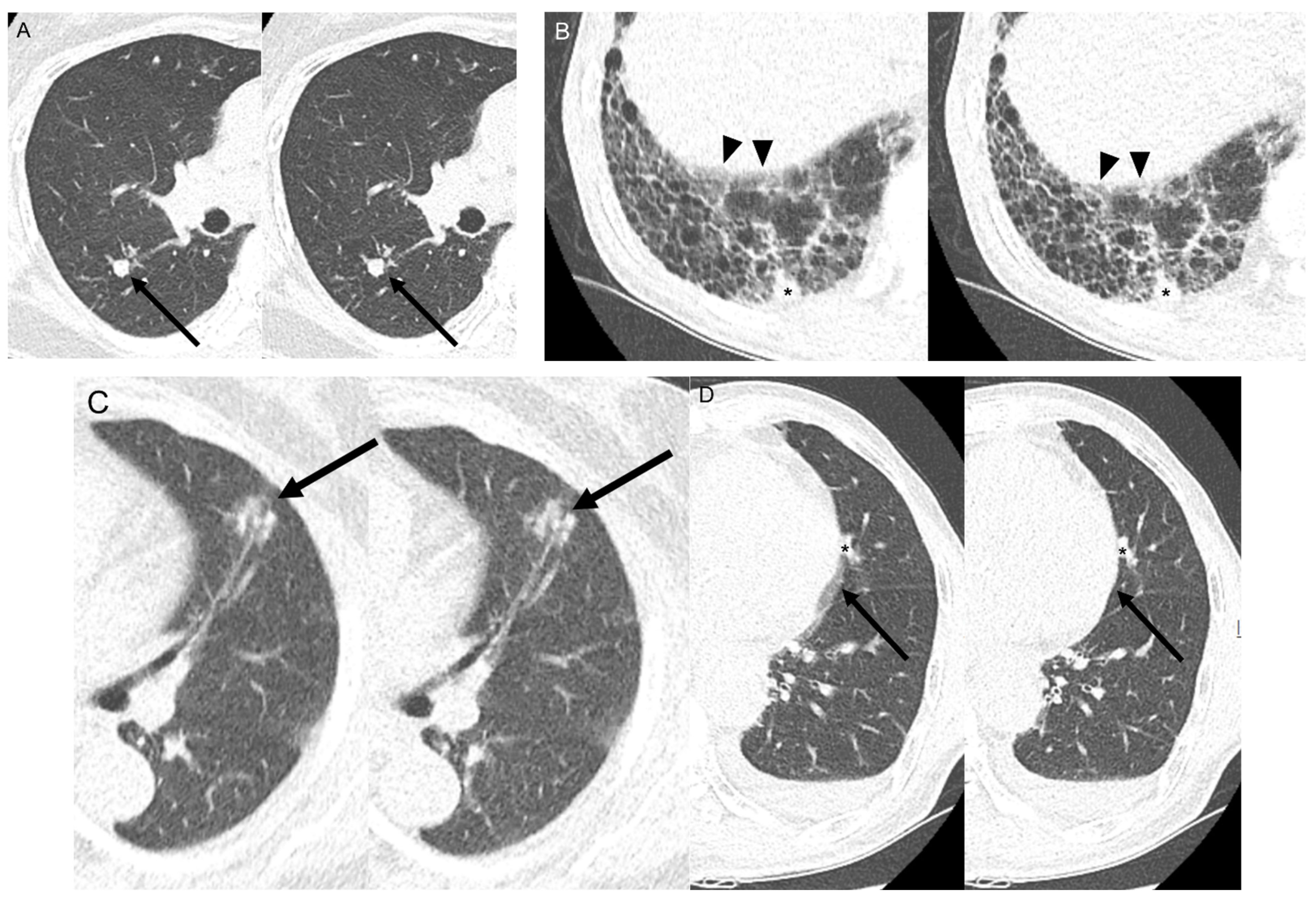 Medicina 60 01301 g004