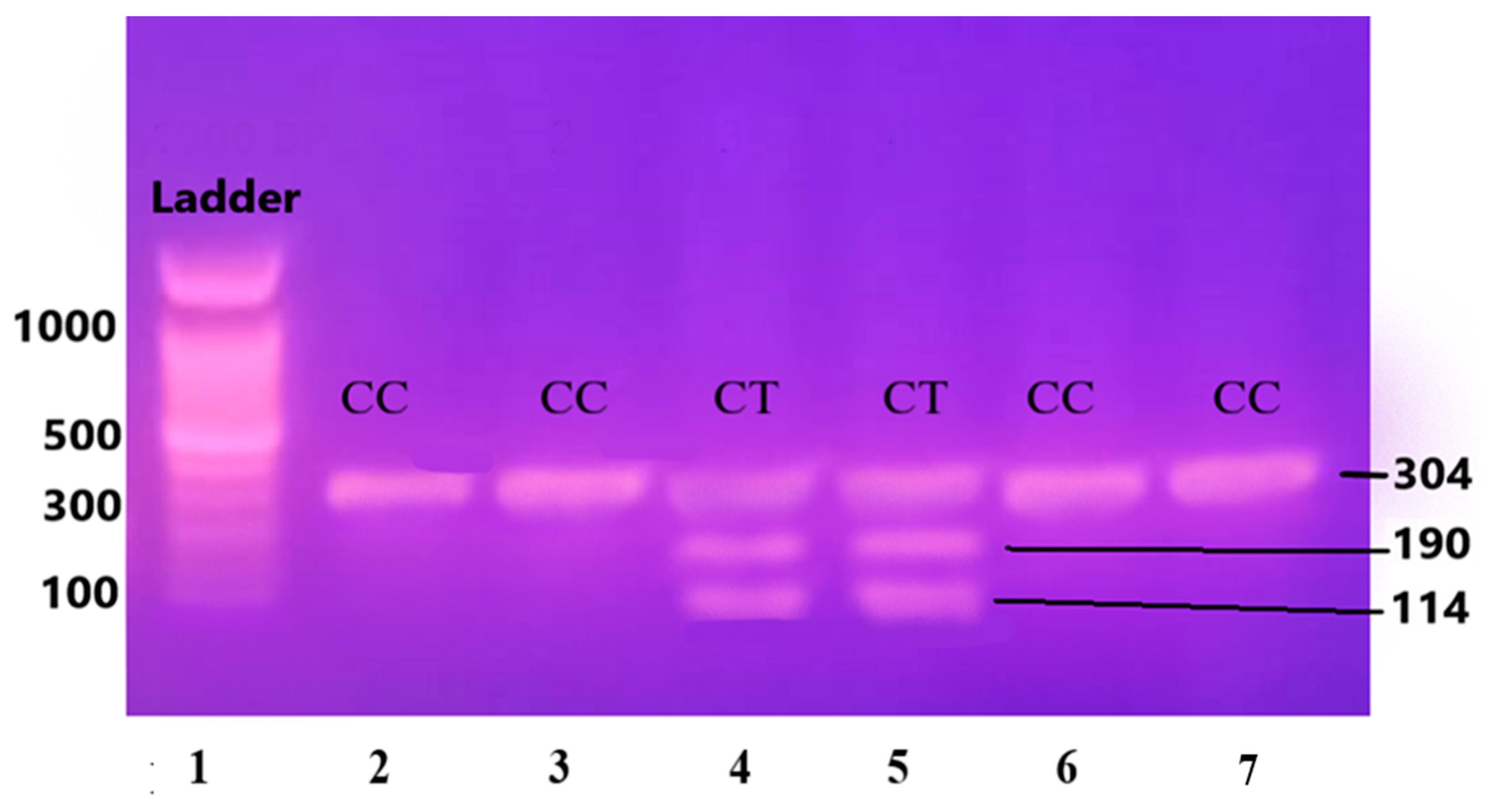 Medicina 60 01307 g004