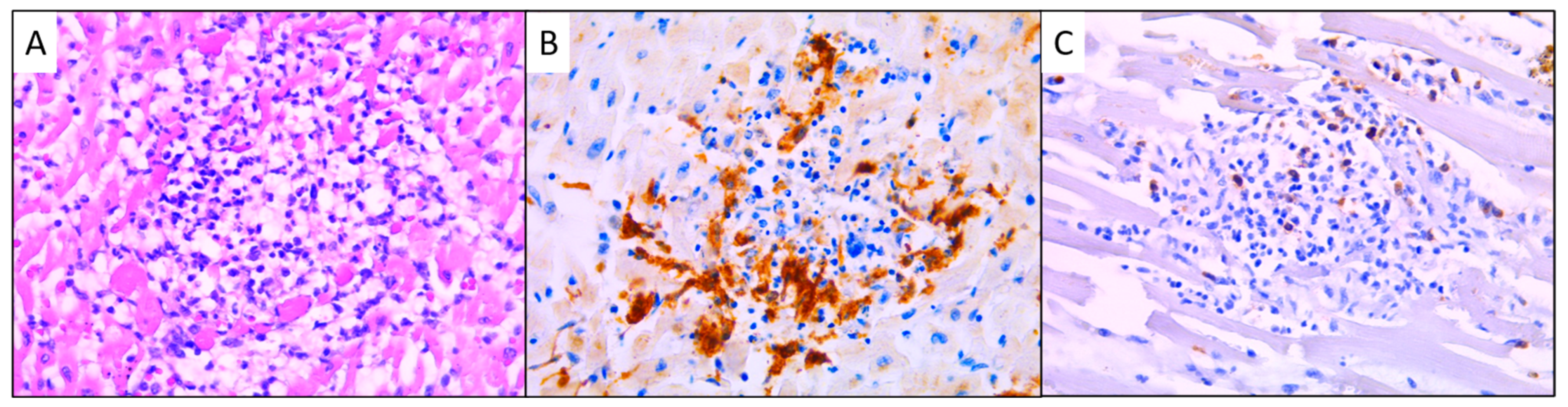 Medicina 60 01312 g004