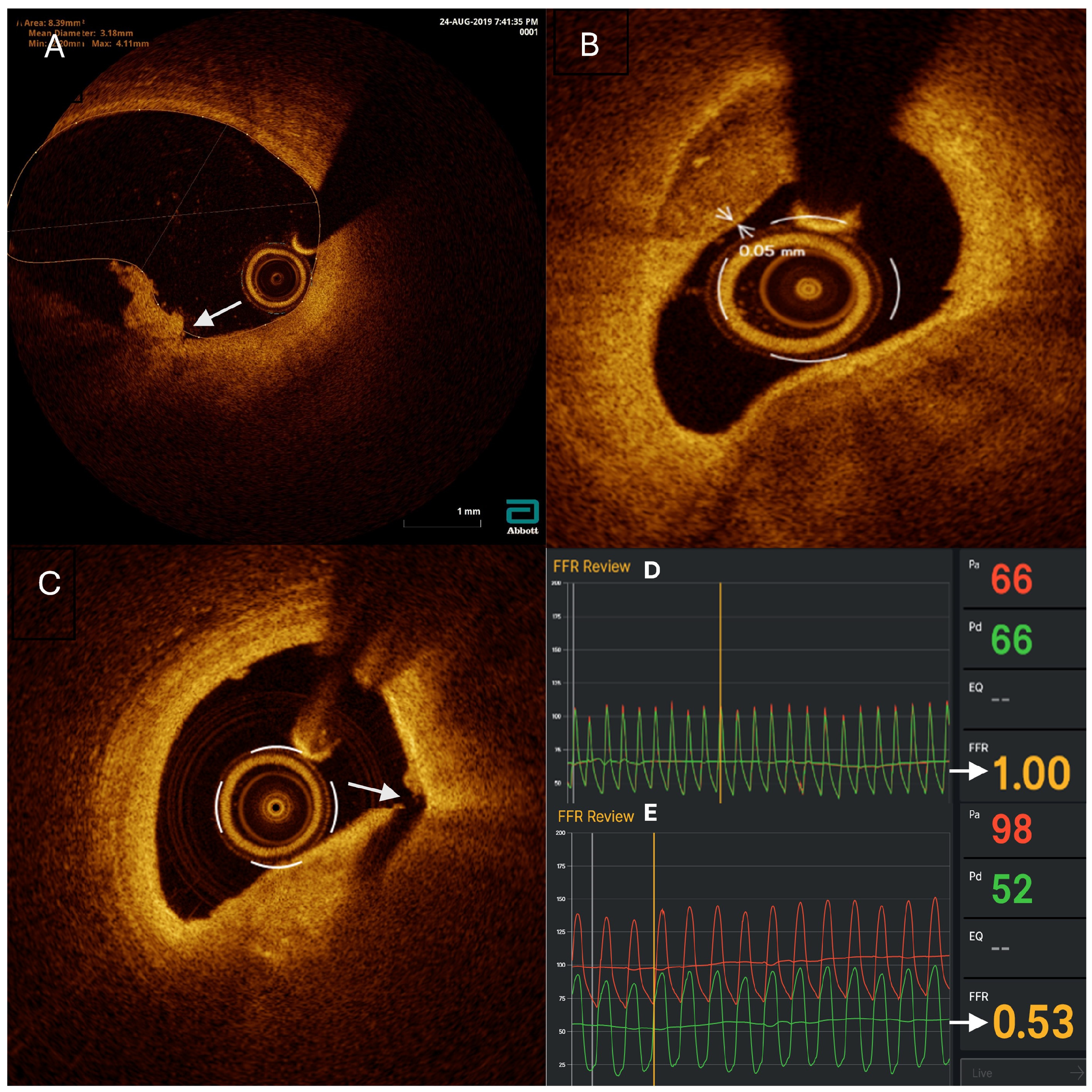 Medicina 60 01320 g001