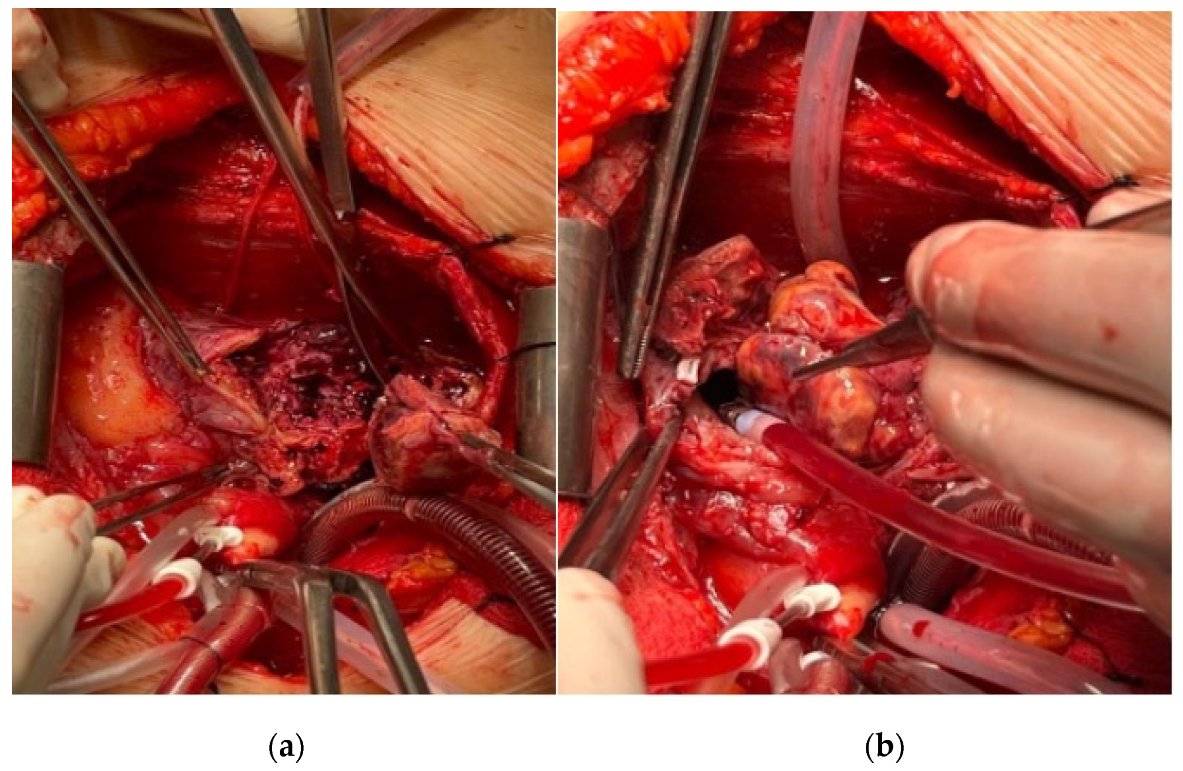 Medicina 60 01321 g002 Medicina 60 01321 g002