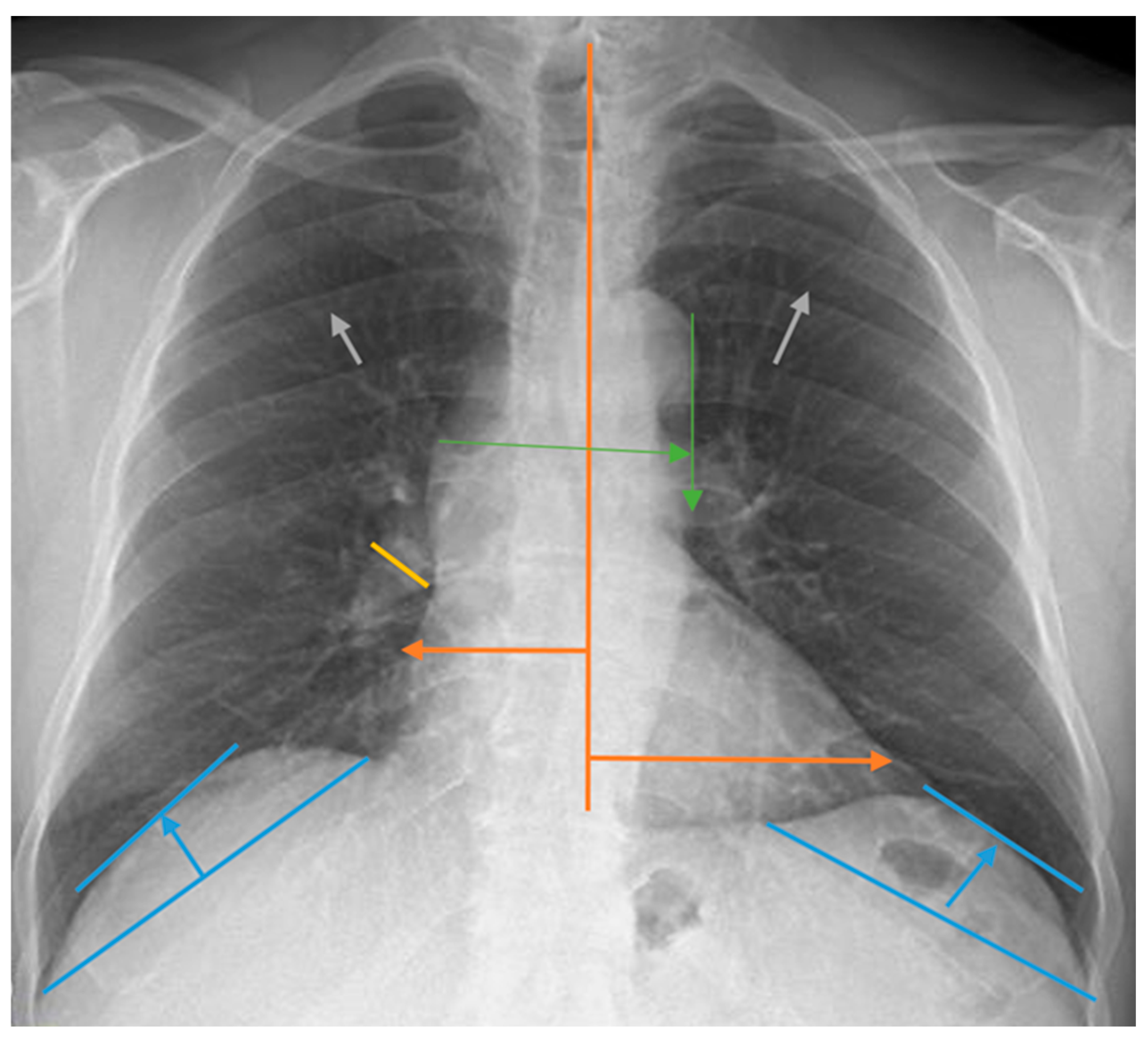 Medicina 60 01331 g001