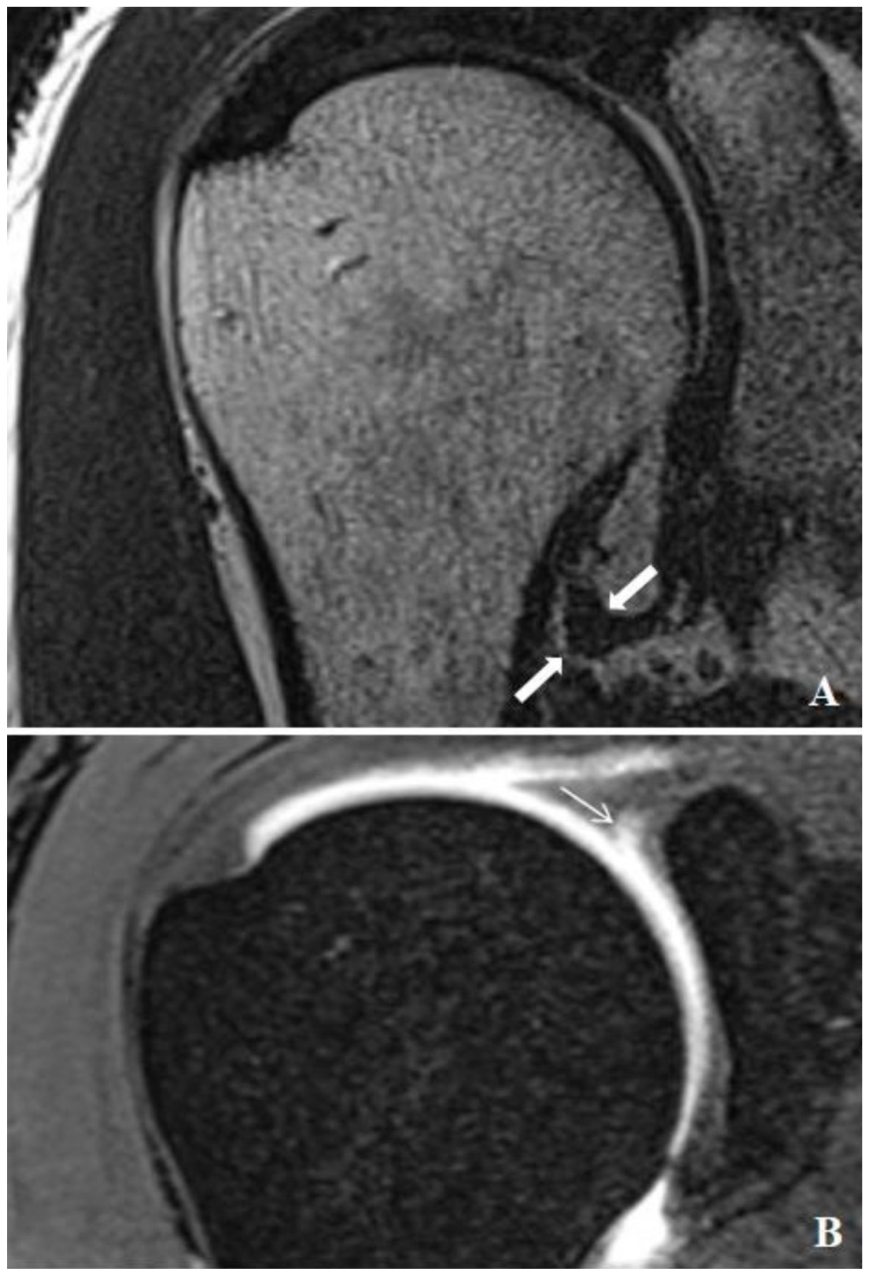 Medicina 60 01332 g002
