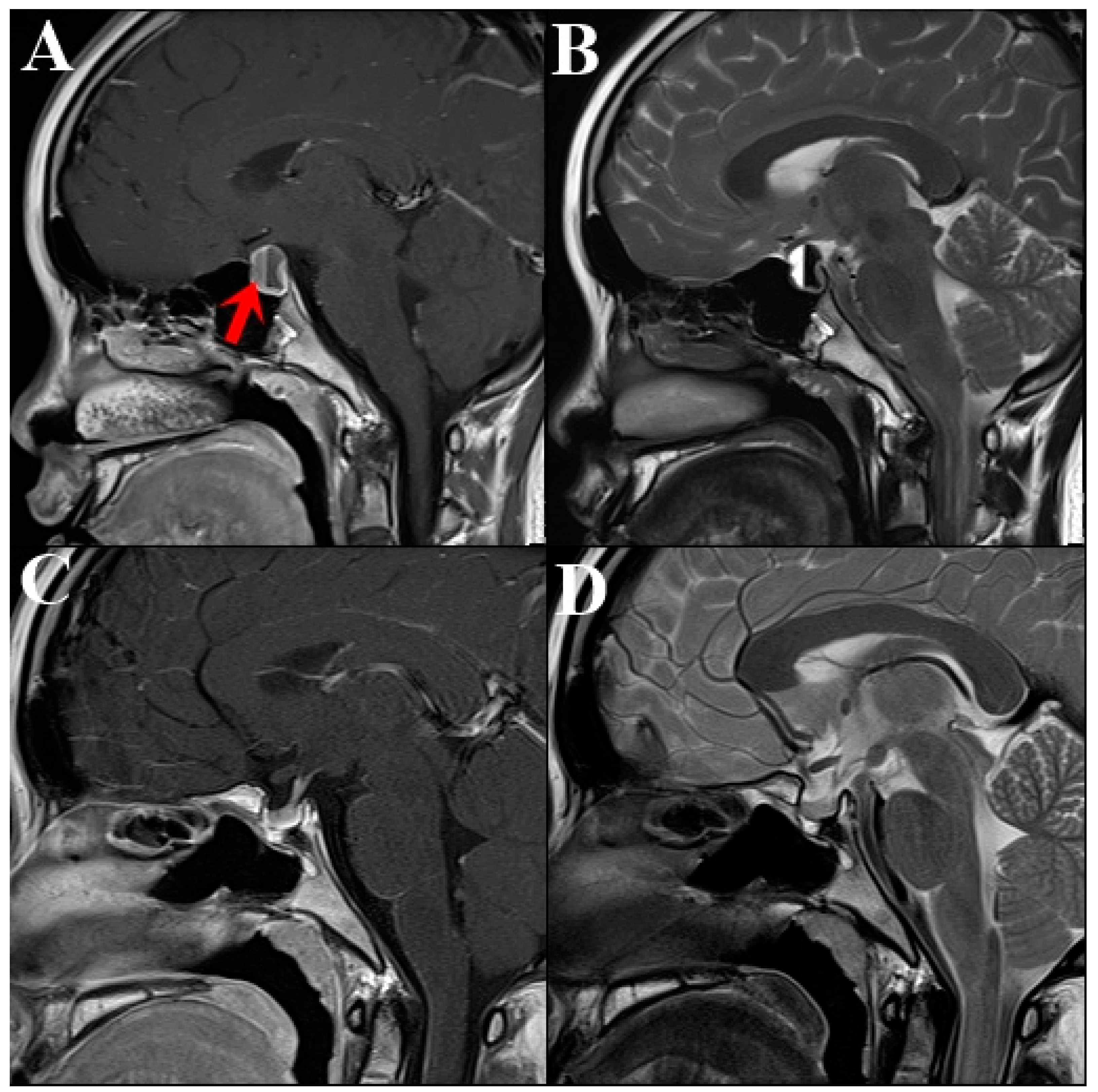 Medicina 60 01345 g001