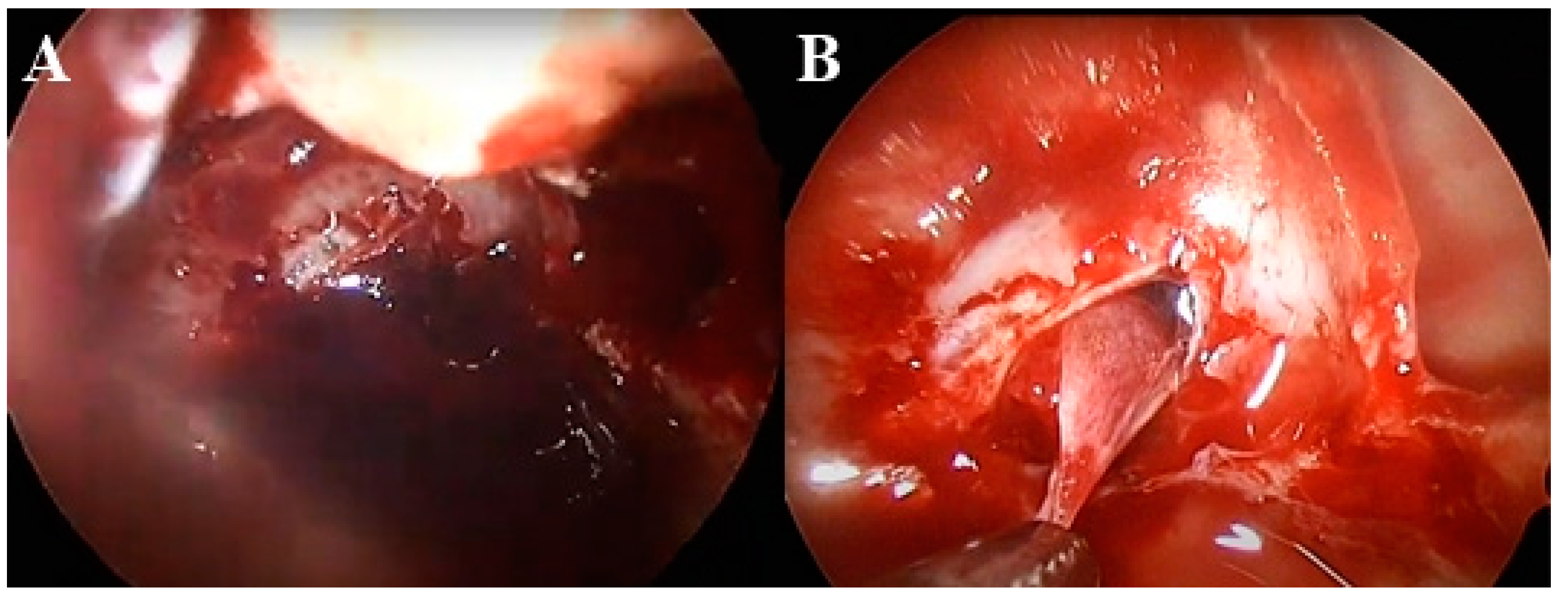 Medicina 60 01345 g002
