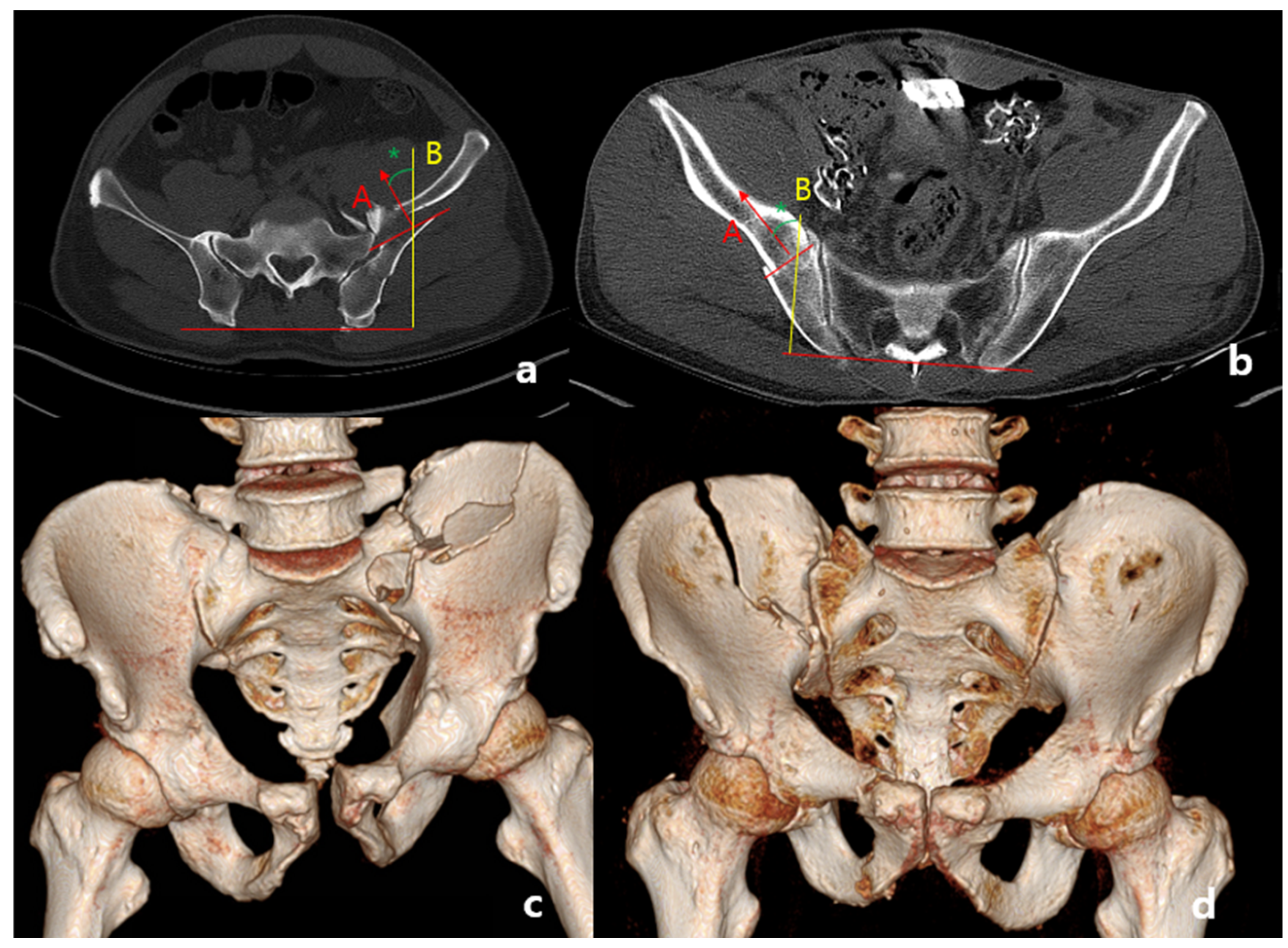 Medicina 60 01375 g002