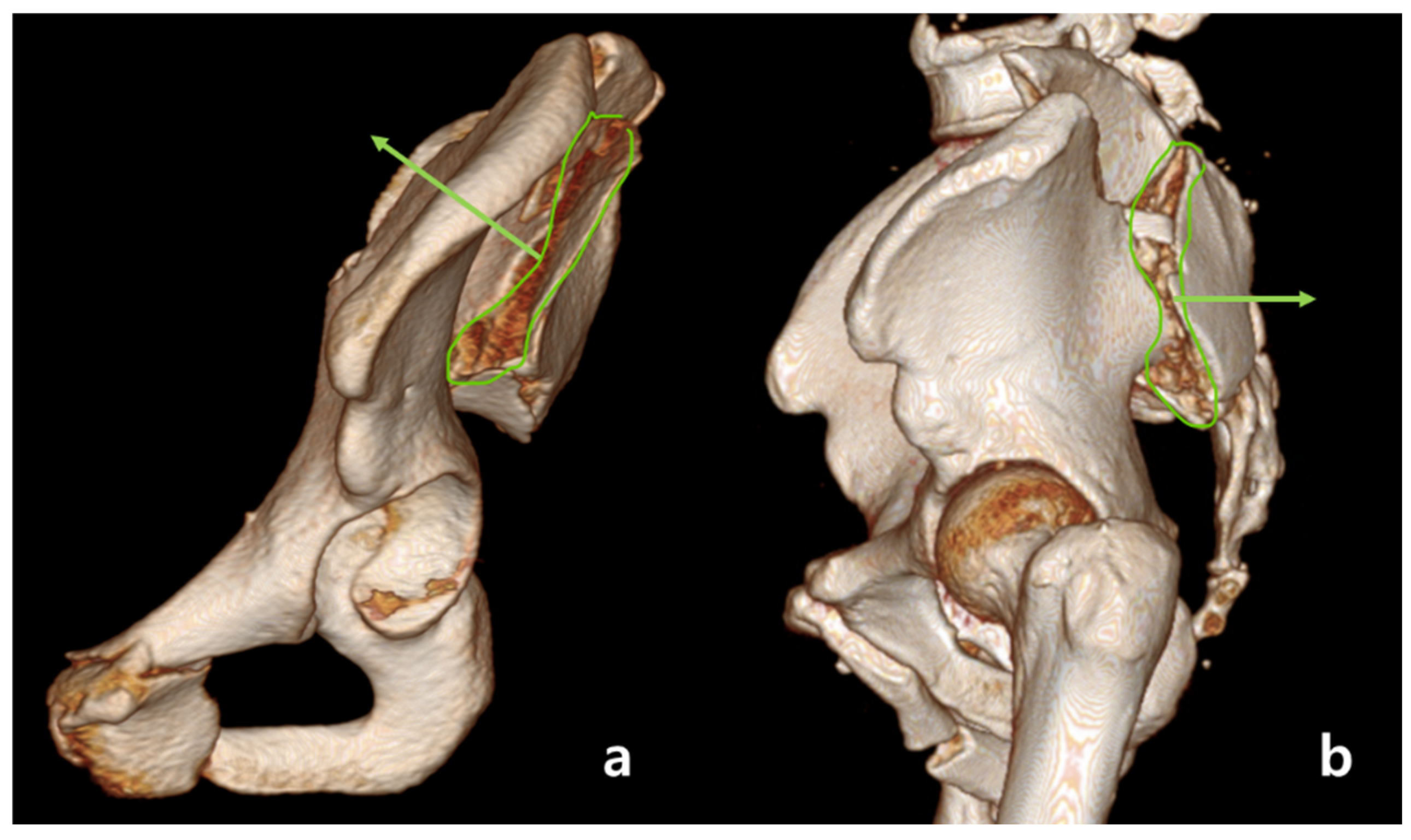 Medicina 60 01375 g003