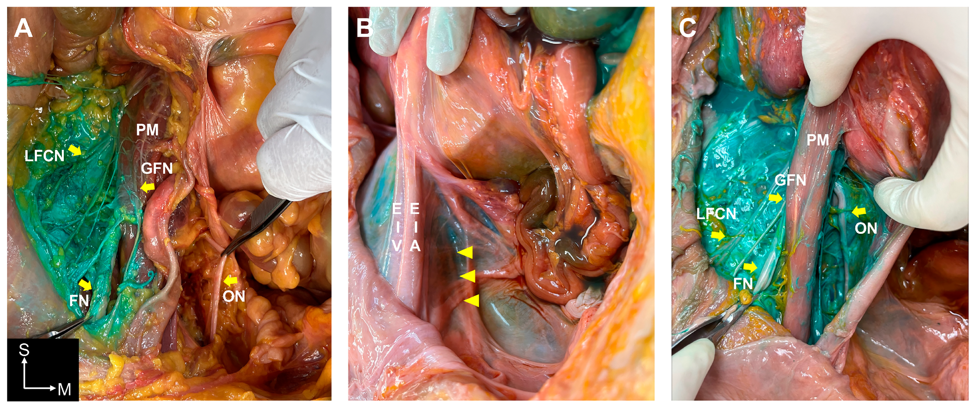 Medicina 60 01391 g002