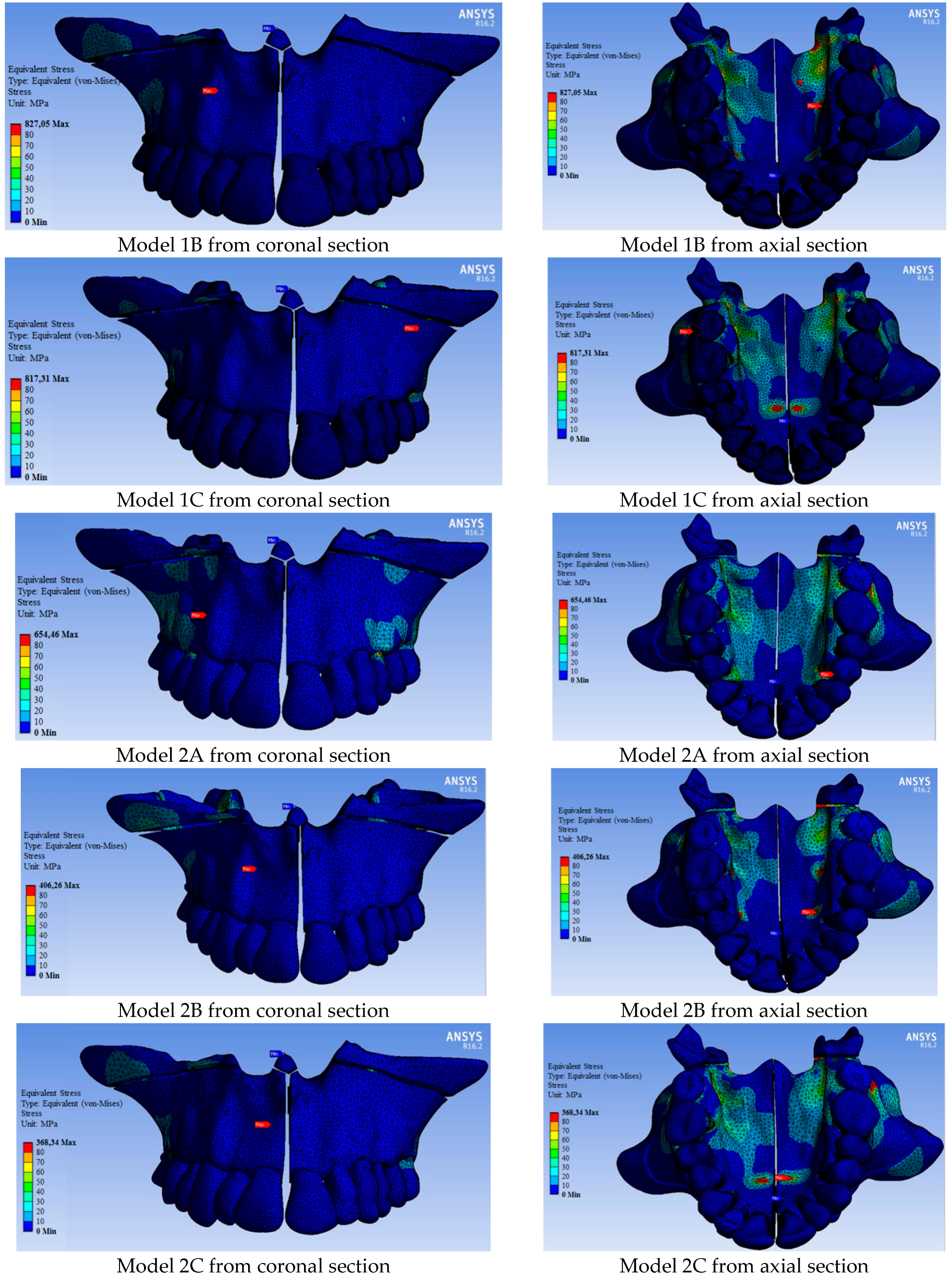 Medicina 60 01400 g004b Medicina 60 01400 g004b