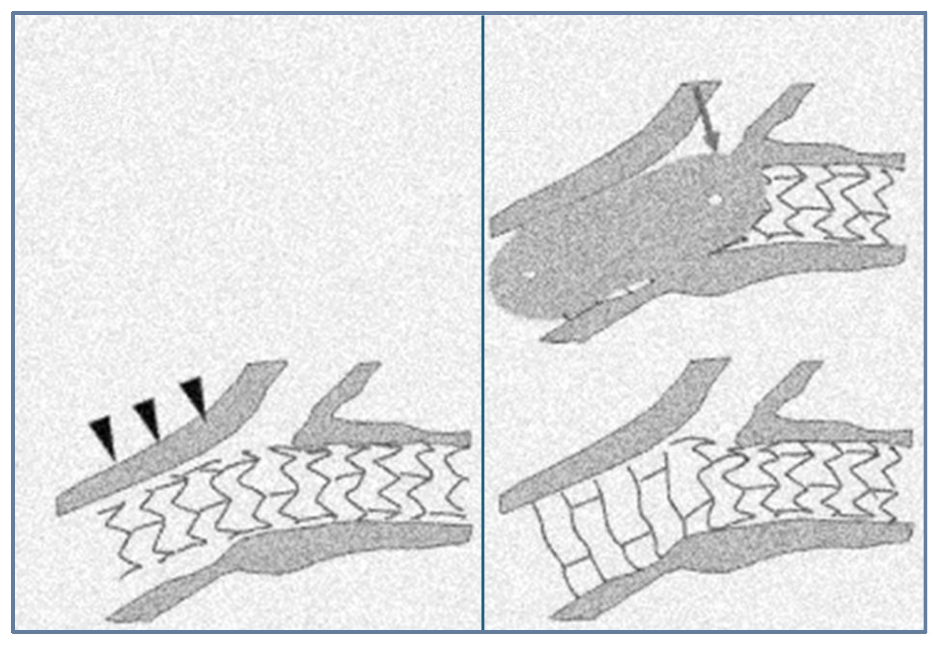 Medicina 60 01439 g003