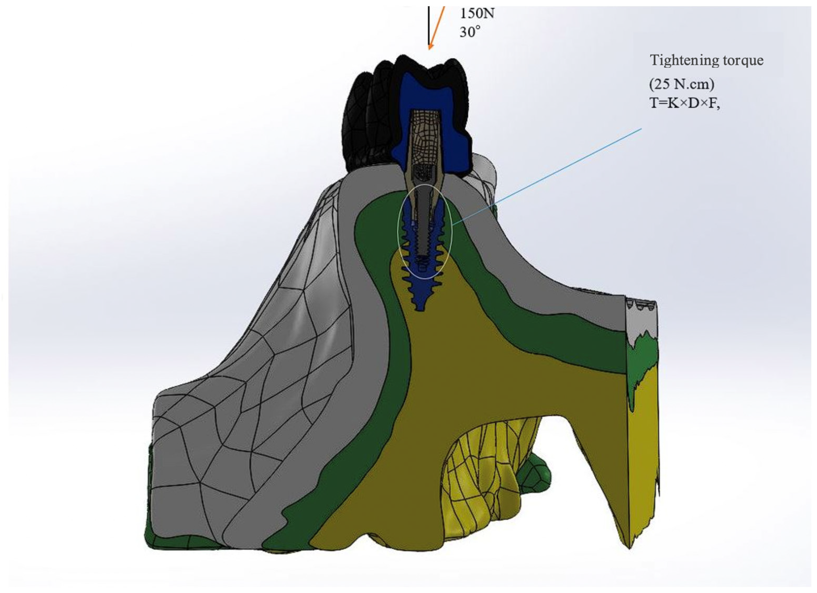 Medicina 60 01463 g003