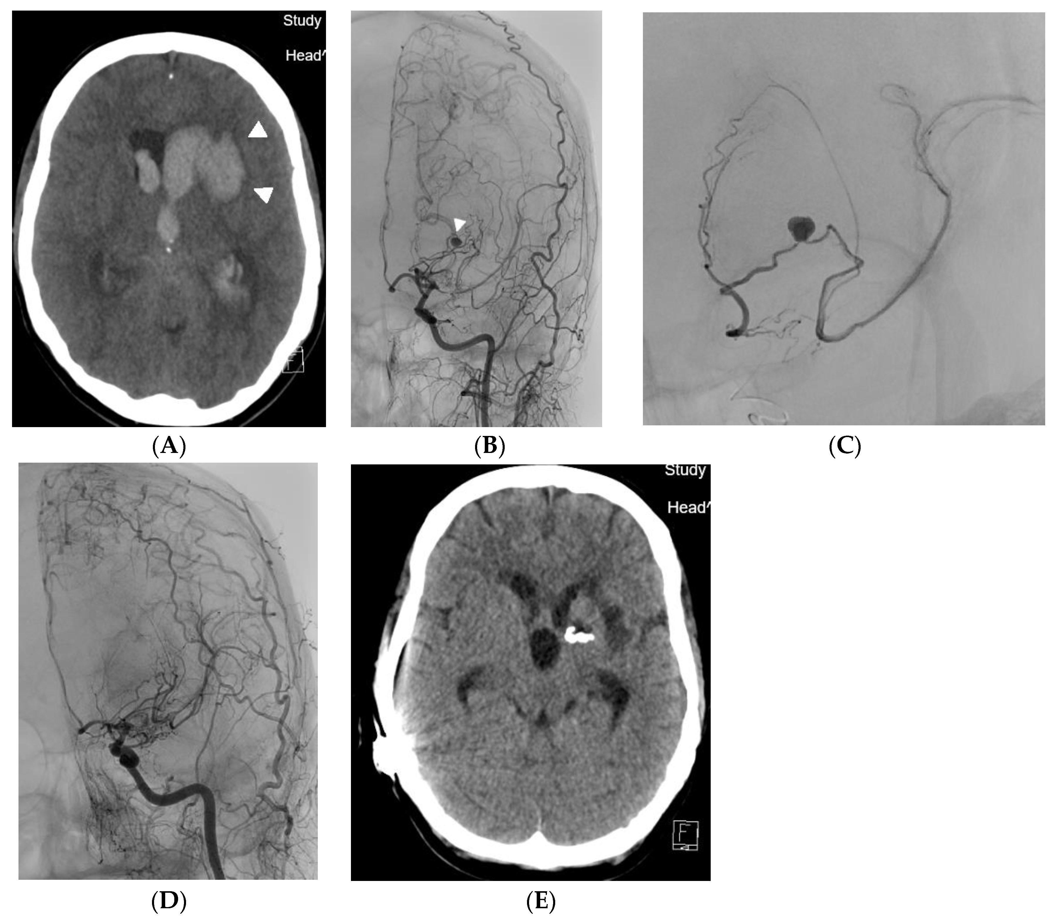 Medicina 60 01499 g001