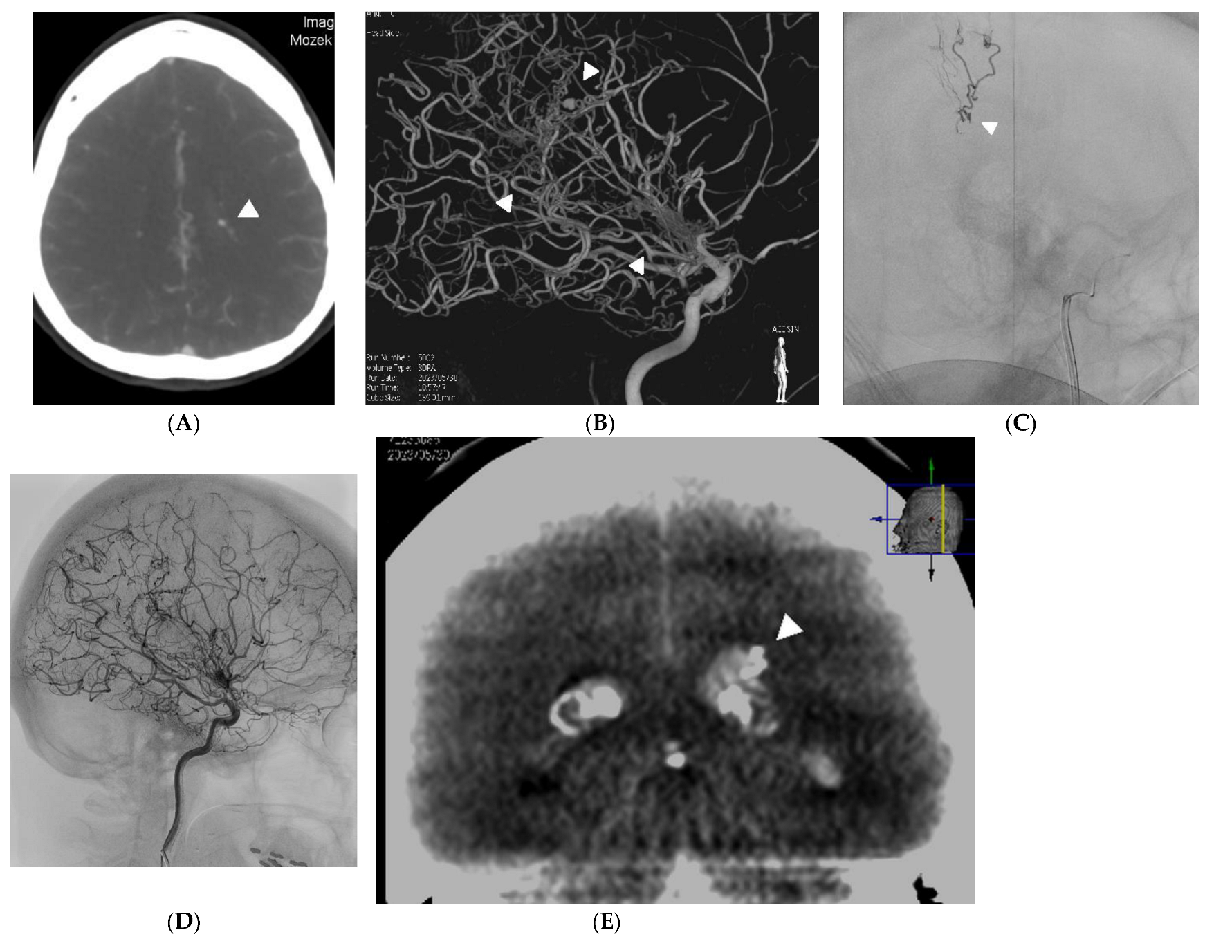Medicina 60 01499 g002