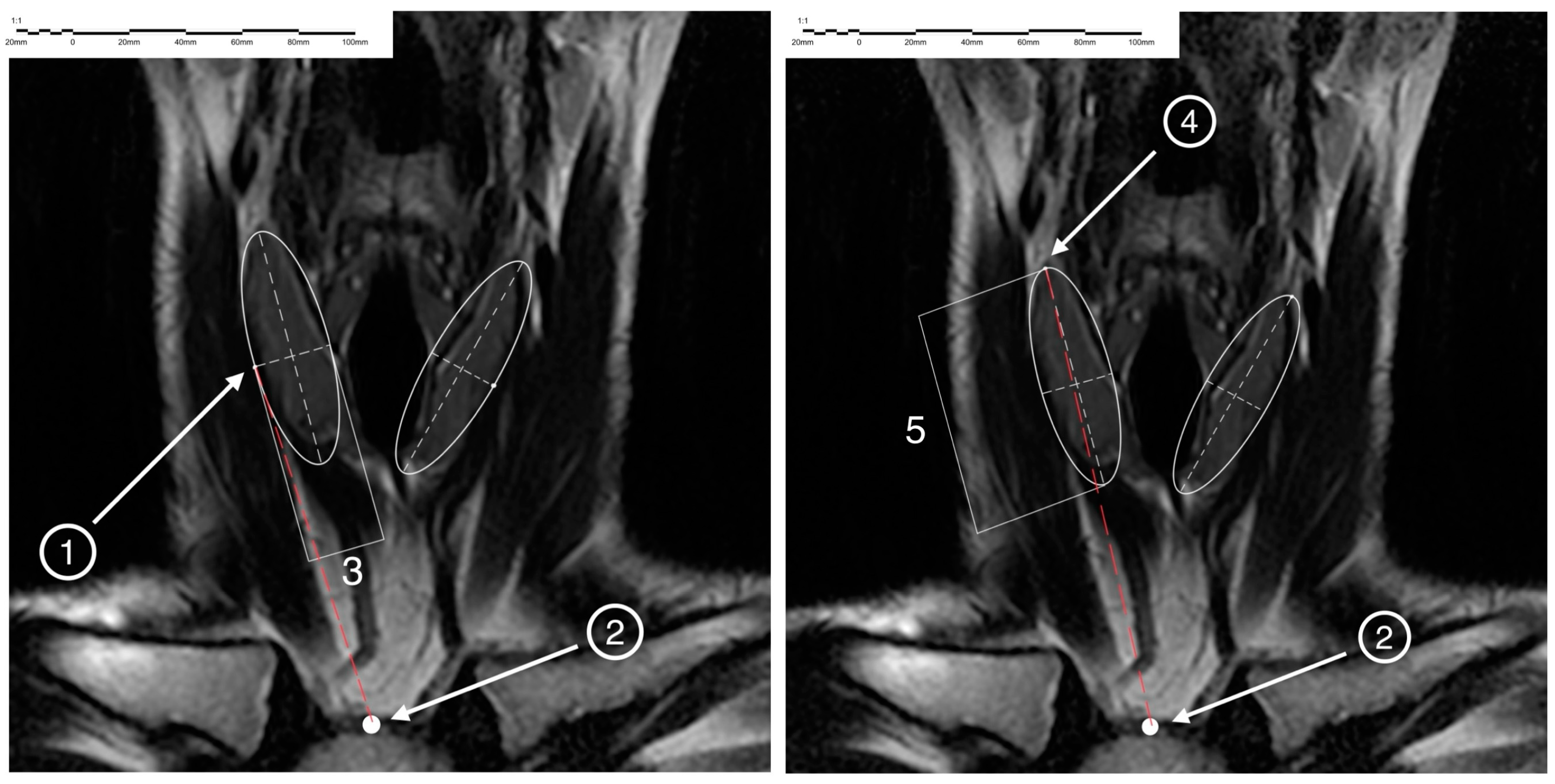 Medicina 60 01520 g002