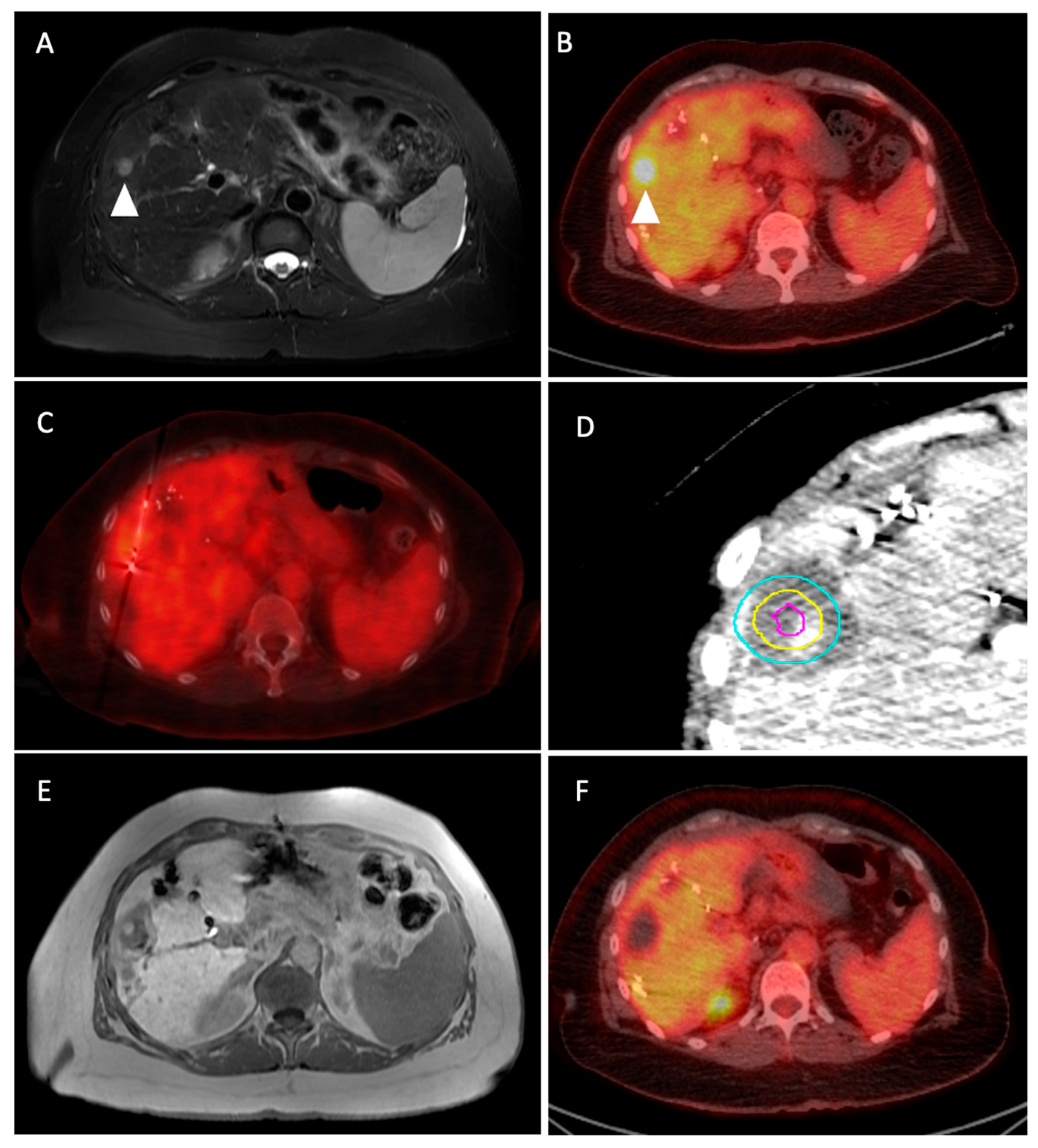 Medicina 60 01536 g001