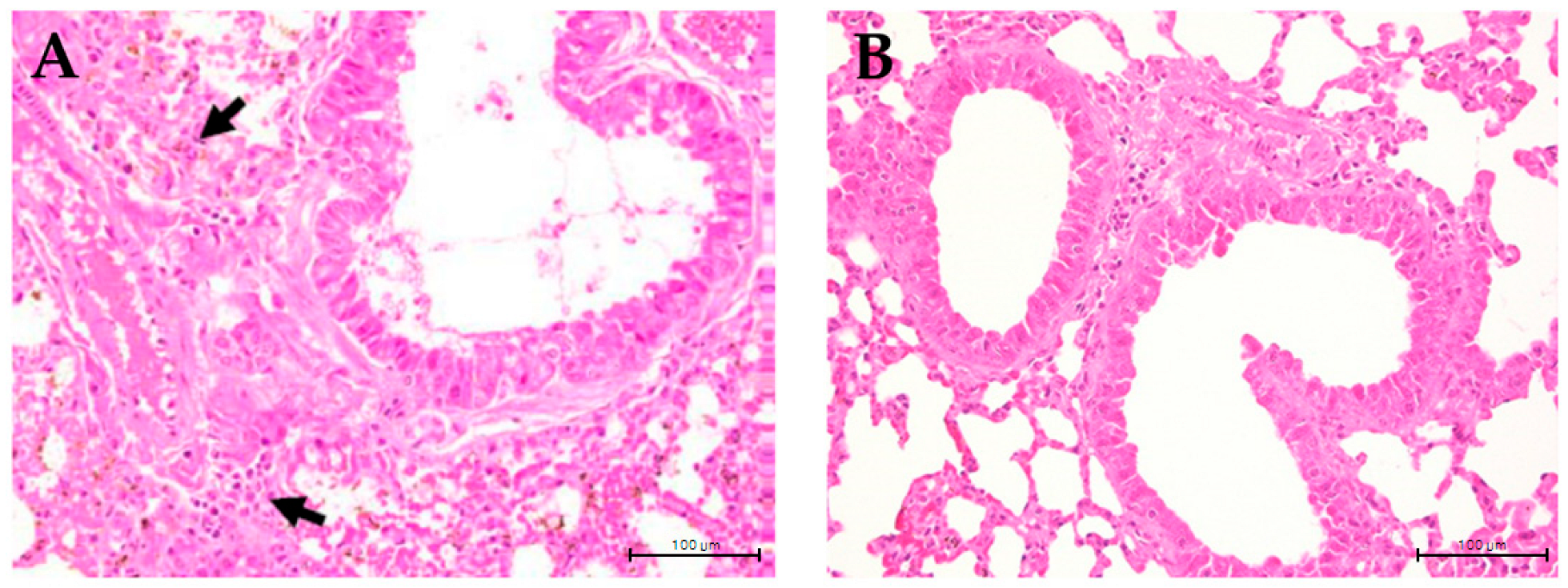 Medicina 60 01545 g005