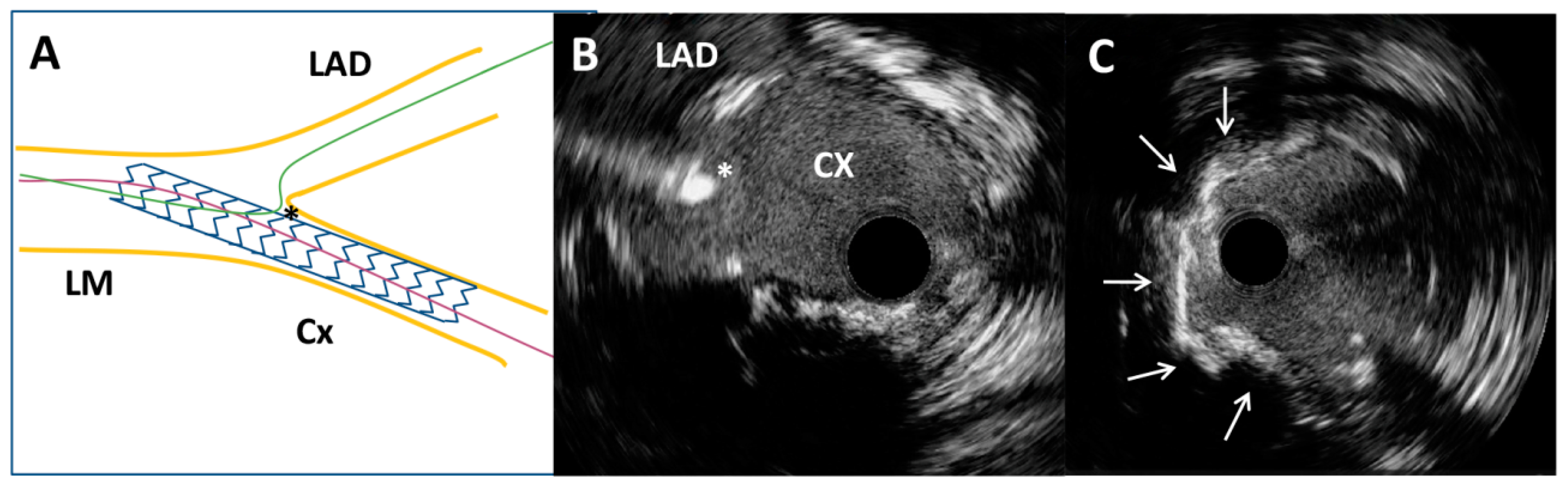 Medicina 60 01563 g003