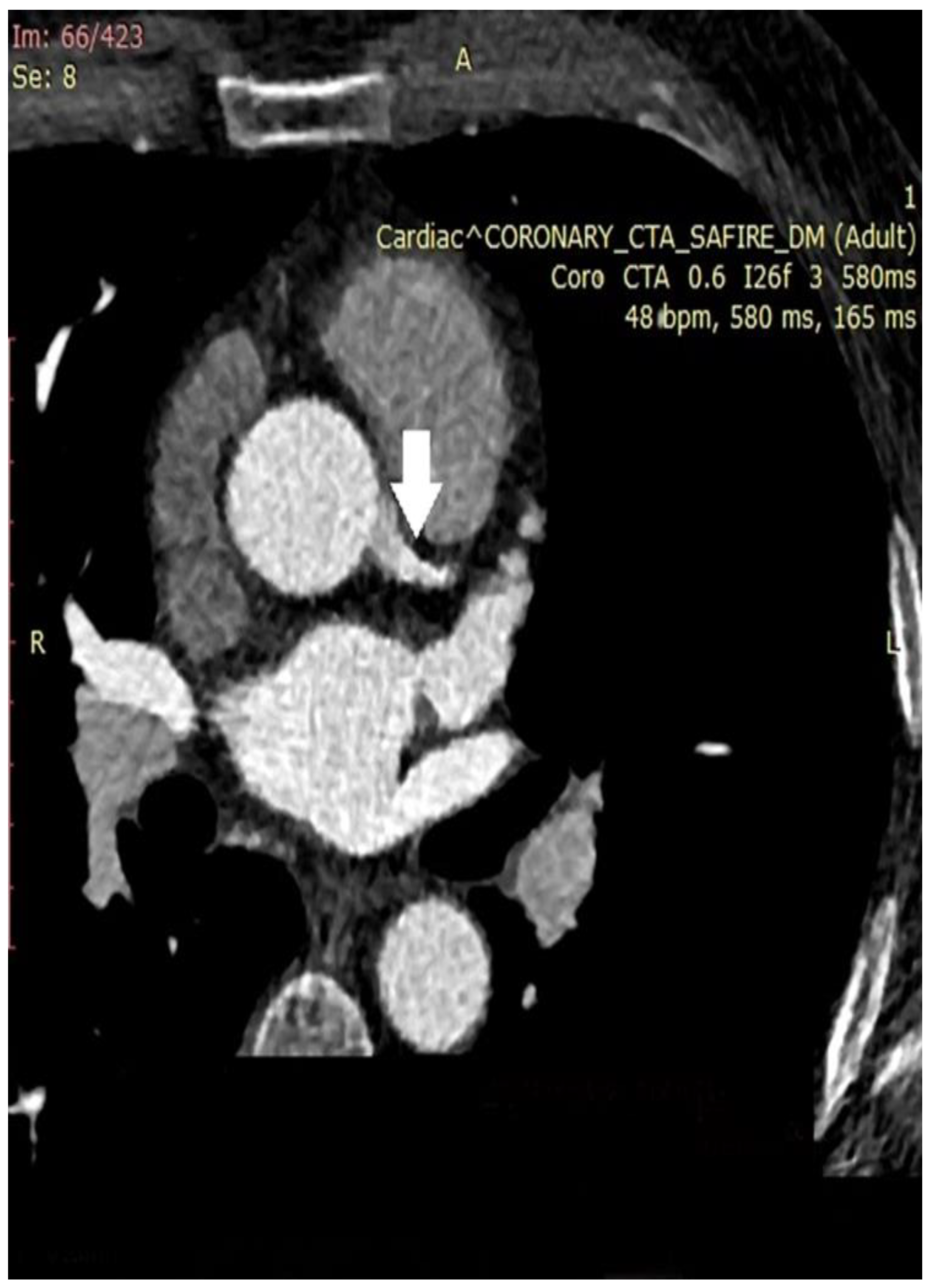 Medicina 60 01574 g003