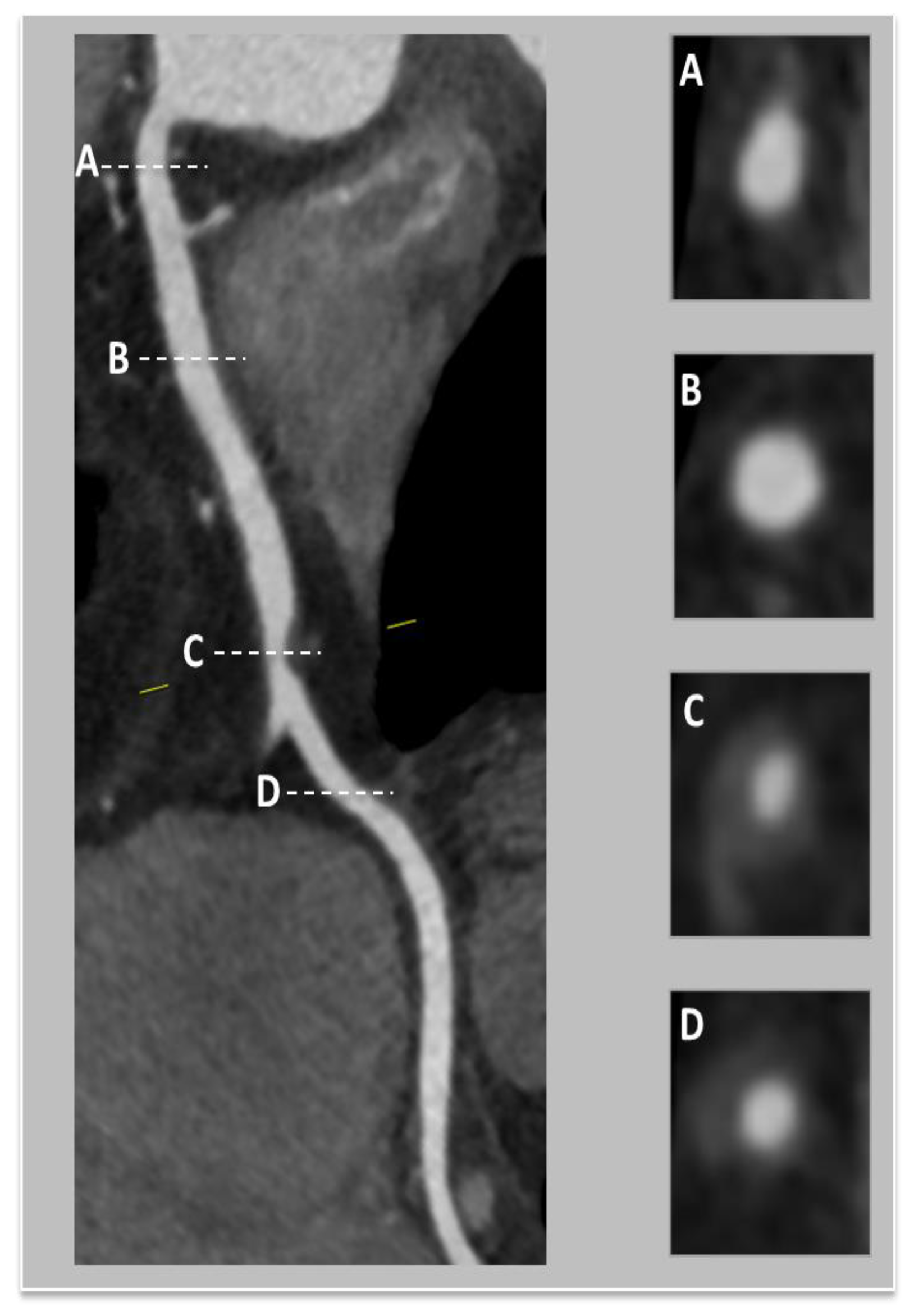 Medicina 60 01574 g005