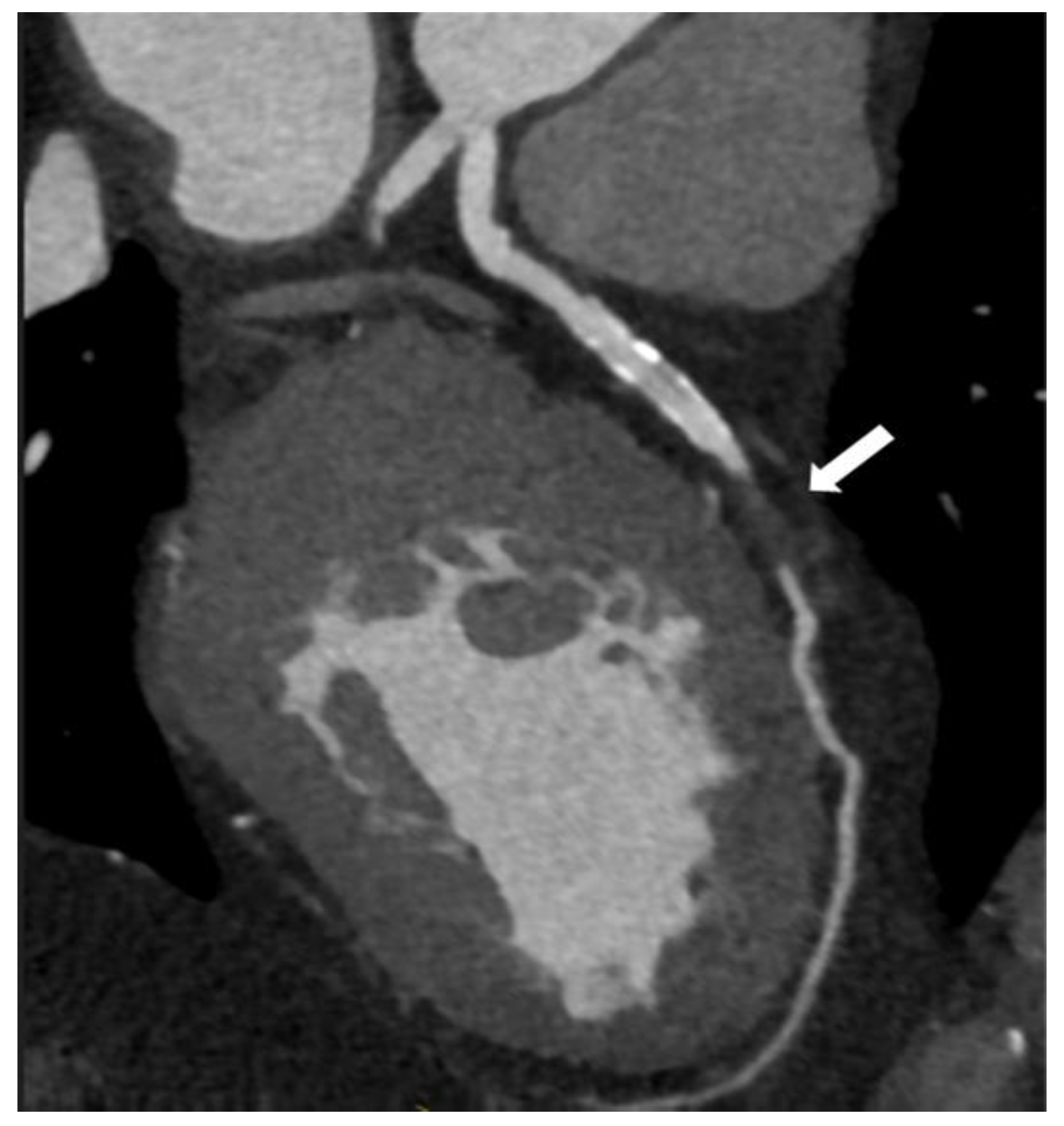 Medicina 60 01574 g006