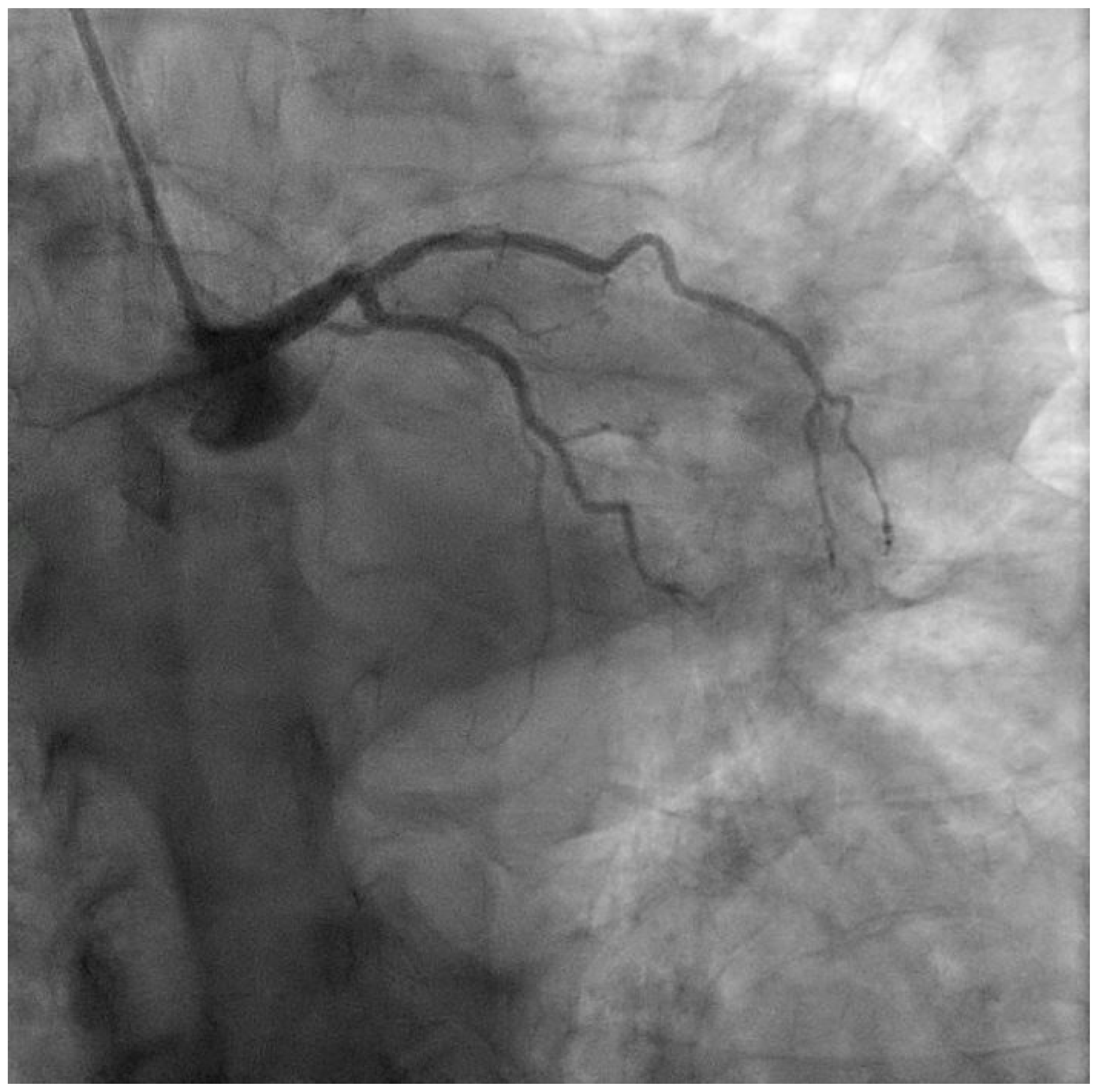 Medicina 60 01595 g001