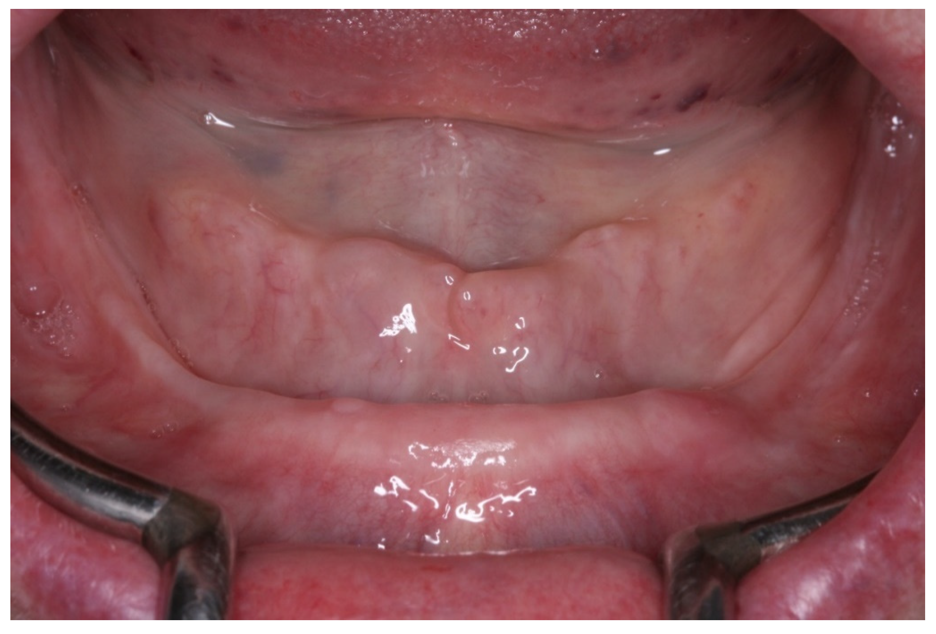 Medicina 60 01614 g001