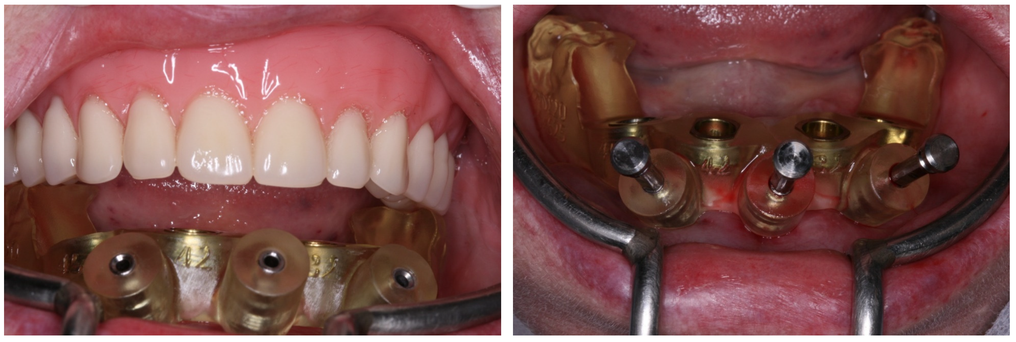 Medicina 60 01614 g005