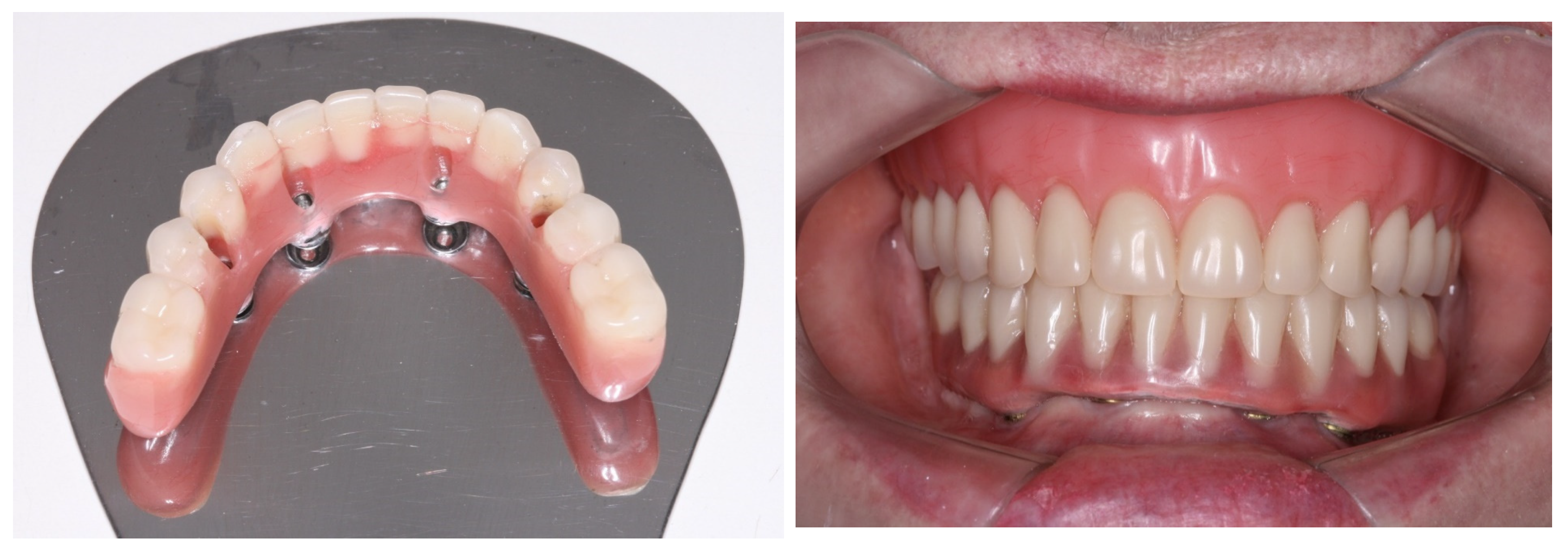 Medicina 60 01614 g011