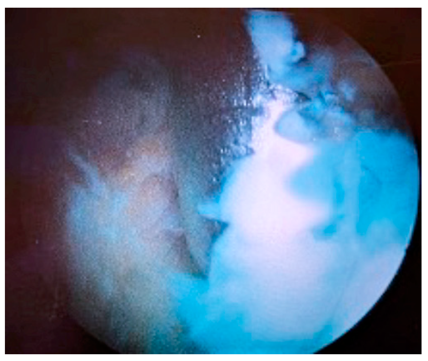 Medicina 60 01636 g003 Medicina 60 01636 g003